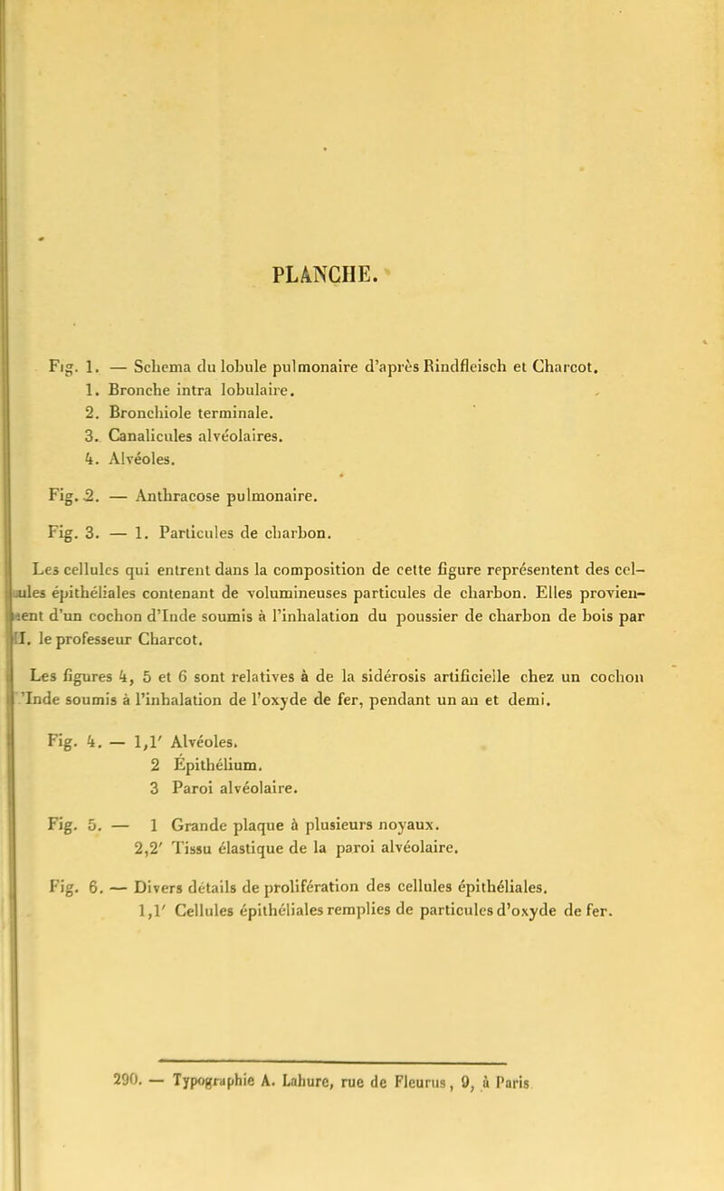 PLANCHE. * Fig. 1. — Schéma du lobule pulmonaire d'après Rindfleisch et Charcot. 1. Bronche intra lobulaire. 2. Bronchiole terminale. 3. Canalicules alvéolaires. k. Alvéoles. Fig. 2. — Anthracose pulmonaire. Fig. 3. — 1. Particules de charbon. Les cellules qui entrent dans la composition de celte figure représentent des cel- és épithéliales contenant de volumineuses particules de charbon. Elles provieu- it d'un cochon d'Inde soumis à l'inhalation du poussier de charbon de bois par i, le professeur Charcot. Les figures k, 5 et 6 sont relatives à de la sidérosls artificielle chez un cochon Inde soumis à l'inhalation de l'oxyde de fer, pendant un an et demi. Fig. k. — l,V Alvéoles. 2 Epithélium. 3 Paroi alvéolaire. Fig. 5. — 1 Grande plaque à plusieurs noyaux. 2,2' Tissu élastique de la paroi alvéolaire. Fig. 6. — Divers détails de prolifération des cellules épithéliales. 1,1' Cellules épithéliales remplies de particules d'oxyde de fer. 290, — Typographie A. Lahure, rue de Fleurus, 9, à Paris