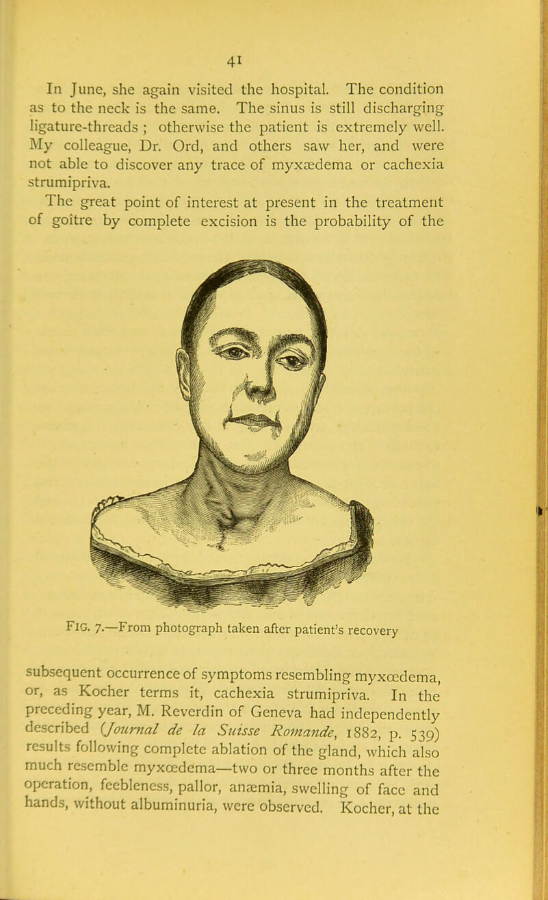 In June, she again visited the hospital. The condition as to the neck is the same. The sinus is still discharging ligature-threads ; otherwise the patient is extremely well. My colleague, Dr. Ord, and others saw her, and were not able to discover any trace of myxasdema or cachexia strumipriva. The great point of interest at present in the treatment of goitre by complete excision is the probability of the Fig. 7.—From photograph taken after patient's recovery subsequent occurrence of symptoms resembling myxoedema, or, as Kocher terms it, cachexia strumipriva. In the preceding year, M. Reverdin of Geneva had independently described {Journal de la Suisse Romande, 1882, p. 539) results following complete ablation of the gland, which also much resemble myxoedema—two or three months after the operation, feebleness, pallor, anemia, swelling of face and hands, without albuminuria, were observed. Kocher, at the