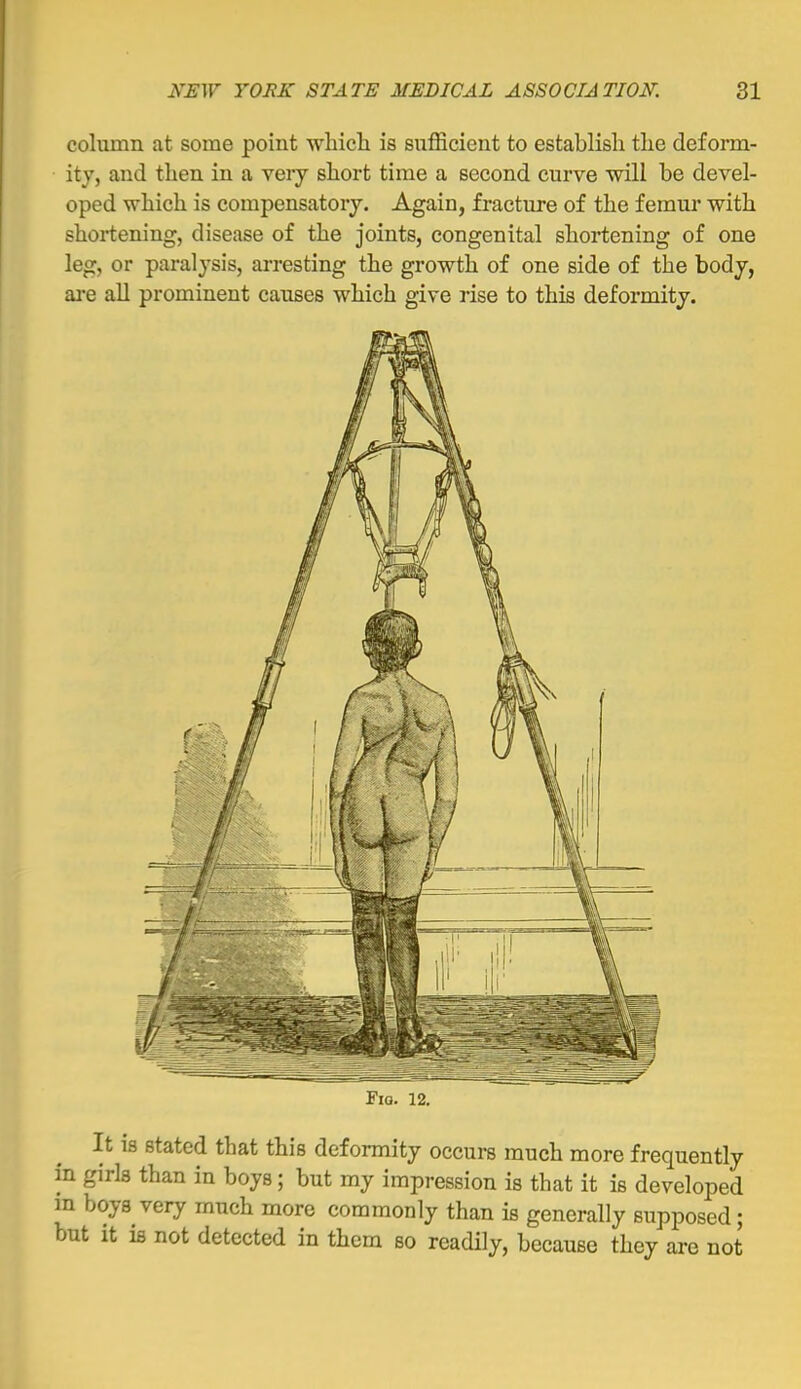 column at some point which is sufficient to establish the deform- ity, and then in a veiy short time a second curve will be devel- oped which is compensatory. Again, fracture of the femur with shortening, disease of the joints, congenital shortening of one leg, or paralysis, arresting the growth of one side of the body, ai-e all prominent causes which give rise to this deformity. It 18 stated that this deformity occui-s much more frequently in girls than in boys; but my impression is that it is developed m boys very much more commonly than is generally supposed; but it is not detected in them so readily, because they are not