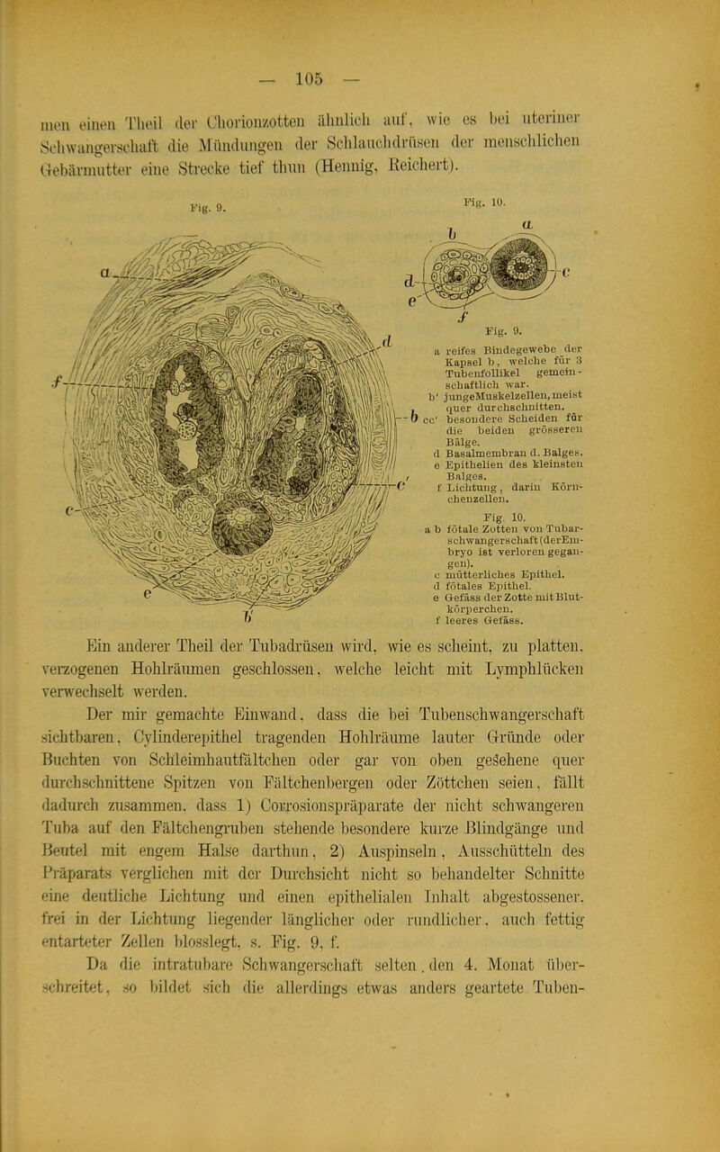 iiu'u oinoii Theil der Uhoriouzotten ähnlich auf, wie es bei uteriuer Schwangerschaft die Mündungen der Sdilauclidriisen der menschliclien Gebärmutter eine Sti-ecke tief thun (Hennig, Keicliert). Fig. 9. Fig. 10. a reifes Biudegewebe der Kapsel b , welclie für 3 Tubeiifollikel gemein - scliaftlich war. b' jungeMuskelzellen,meist , fiuer durchschultten. -0 cC besondere Scheiden für die beiden grösseren Bfilge. d Basalmembran d. Balget-, e Epithelien des kleinsten Balges, f Lichtung, darin Körn- chenzelleu. Fig. 10. a b fötale Zotten von Tubar- schwangerschaft (derEni- bryo ist verloren gegan- gen). c mütterliches Epithel, d fötales Epithel. 6 Gefäss der Zotte mit Blut- körperchen, f leeres Gefäss. Ein anderer Theil der Tubadrüseu wird, wie es scheint, zu platten, vei-zogenen Hohlräumen geschlossen, welche leicht mit Lymphlücken verwechselt werden. Der mir gemachte Einwand, dass die bei Tubenschwangerschaft sichtbaren, Cylinderepithel tragenden Hohlräume lauter G-rimde oder Buchten von Scbleimhautfältchen oder gar von oben gegebene quer durchschnittene Spitzen von Fältchenbergeu oder Zöttchen seien, fällt dadurch zusammen, dass 1) Corrosionspräparate der nicht schwangeren Tuba auf den Fältchengruben stehende besondere kurze Bliudgänge und Beutel mit engem Halse darthun, 2) Auspinseln, Ausschütteln des Präparats verglichen mit der Durchsicht nicht so behandelter Schnitte eine deutliche Lichtung imd einen epithelialen Lihalt abgestossener. frei in der Lichtung liegender länglicher oder rundlicher, auch fettig entarteter Zellen blosslegt, s. Fig. 9, f. Da die intratubare Schwangerschaft selten. den 4. Monat übei- schreitet, .so bildet .sich die allerdings etwas anders geartete Tuben-