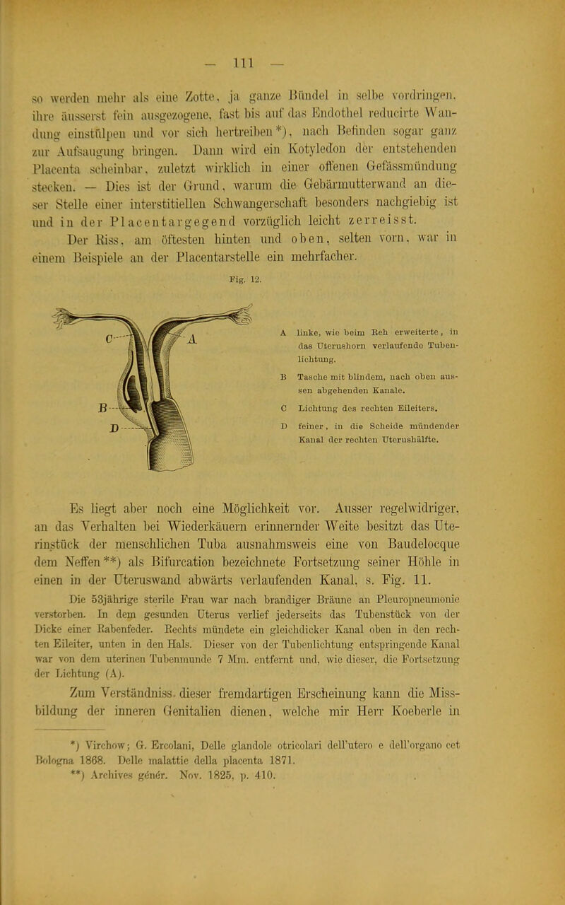 so werdon inehi- als eine Zotte, ja ganze Bündel in selbe vordringen, ihre äusserst fein ausgezogene, last bis auf das Endothel reducirte Wan- dung eiusti-dpeu und vor sich hertreiben*), nach Beünden sogar ganz zur Aufsaugung bringen. Dann wird ein Kotyledon der entstehenden Placenta scheinbar, zuletzt wirklich in einer offenen Gefässmündung stecken. — Dies ist der Grund, warum die^ Gebärmutterwand an die- ser Stelle einer interstitiellen Schwangerschaft besonders nachgiebig ist und in der Placenta rgegend vorzüglich leicht zerr eis st. Der Eiss. am öftesten hinten und oben, selten vorn, war in einem Beispiele an der Placentarstelle ein mehrfacher. Fig. 12. A linke, wie beim Keh erweiterte, in das Uterushorn verlaufende Tuben- lichtung. B Tasche mit blindem, nach oben aus- sen abgehenden Kanäle. C Lichtung des rechten Eileiters. D feiner, in die Scheide mündender Kanal der rechten TJterushälfte. Es liegt aber noch eine Möglichkeit vor. Ausser regelwidriger, an das Verhalten bei Wiederkäuern erinnernder Weite besitzt das üte- rinstiick der menschlichen Tuba ausnahmsweis eine von Baudelocqne dem Neffen**) als Bifurcation bezeichnete Fortsetzung seiner Höhle in einen in der Uteruswand abwärts verlaufenden Kanal, s. Fig. 11. Die 53jährige sterile Frau war nach brandiger Bräune an Pleuropneumonie verstorben. In dem gesunden Uterus verlief jederseits das Tubenstück von der Dicke einer Eabenfeder. Eechts mündete ein gleichdicker Kanal oben in den rech- ten Eileiter, unten in den Hals. Dieser von der Tubenlichtung entspringende Kanal war von dem uterinen Tubenmunde 7 Mm. entfernt und, wie dieser, die Fortsetzung der Lichtung (Aj. Zum Verständniss. dieser fremdartigen Erscheinung kann die Miss- bildung der inneren Genitalien dienen, welche mir Herr Koeberle in *) Virchow; G. Ercolaiii, Delle glandole otricolari dell'utero e dell'organo cet Bologna 1868. Delle malattie della placenta 1871. **) Archives gönör. Nov. 1825, p. 410.