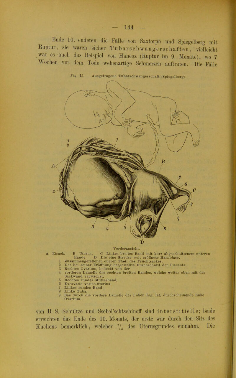Eiule 10. endeten die Fälle von Saxtorph und Spiegelberg mit Knptur, sie waren sicher Tub ar schwang er sc h af ten , vielleicht .war es auch das Beispiel von Hancox (Ruptur im 9. Monate), wo 7 Wochen vor dem Tode wehenartige Schmerzen auftraten. Die Fälle Fig. 15. Ausgetragene TubarKcliwaiigerschaft (Spiegelberg). A EiRacli. B Uterus. C Linkes breites Band mit kurz abgeschnittenem unteren Eande. D Die eine Strecke weit eröffnete Harnblase. 1 Zusammengefallener oberer TUeil des Fruchtsackes. 2 Der bei seiner Eröffnung hergestellte Durchschnitt der Placeuta. 3 Rechtes Ovarium, bedeckt von der 4 vorderen Lamelle des recliten breiten Bandes, welche welter oben mit der Sackwand vorwächst. 5 Rechtes rundes Mutterband. 6 Excavatio vesico-uterina. 7 Linkes rundes Band. 8 Linke Tuba. 9 Das durcli die vordere Lamelle des linken Lig. lat. durchscheinende linke Ovarium. von B. S. Schultze und SsoboFschtschinolf sind interstitielle; beide erreichten das Ende des 10. Monats, der erste war durch den Sitz des Kuchens bemerklich, welcher ^/j des Uterusgrandes eüuiahm. Die