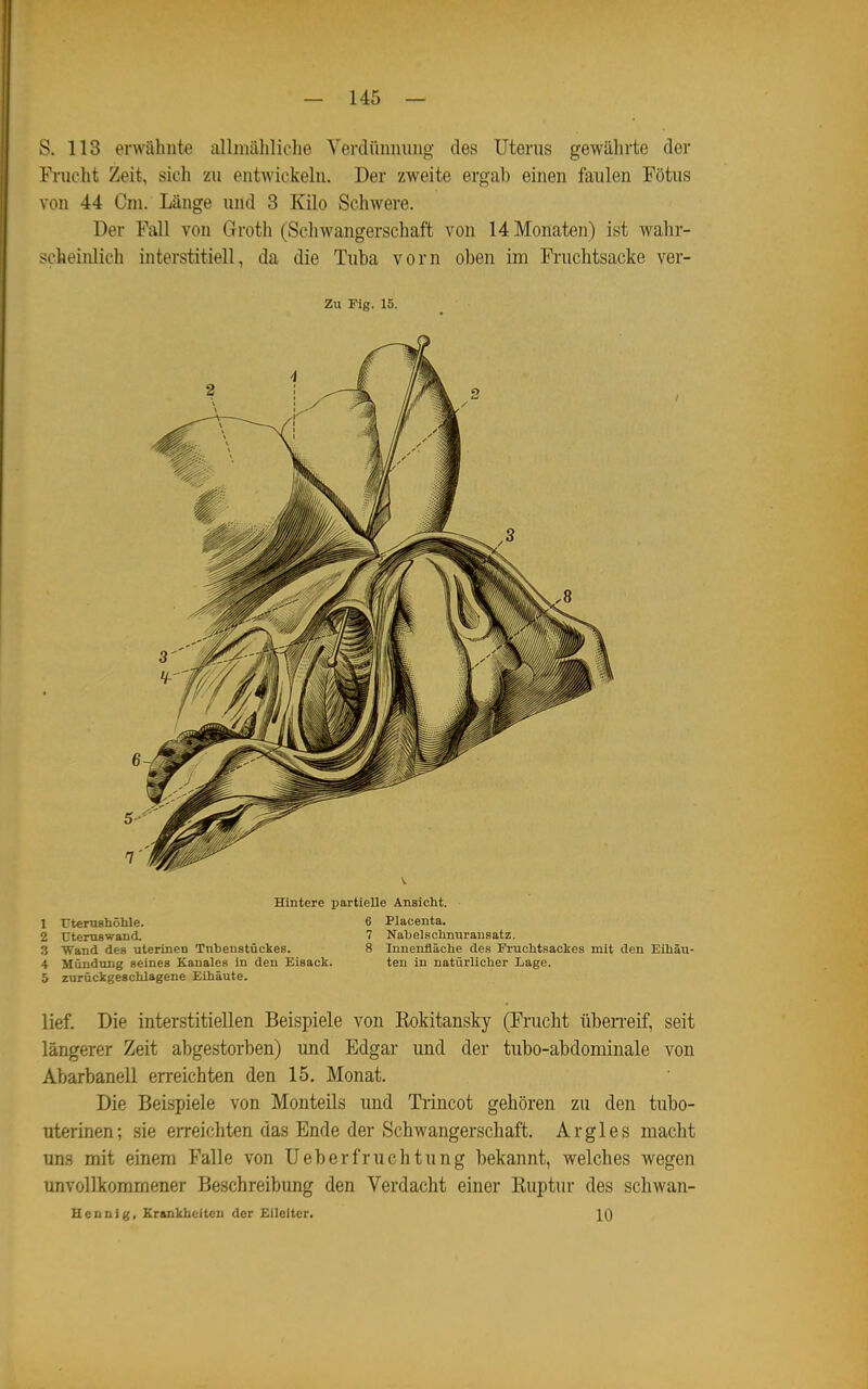 S. 113 erwähnte allmähliche Verdünnung des Uterus gewährte der Frucht Zeit, sich zu entwickeln. Der zweite ergab einen faulen Fötus von 44 Cni. Länge und 3 Küo Schwere. Der Fall von Groth (Schwangerschaft von 14 Monaten) ist wahr- scheinlich interstitiell, da die Tuba vorn oben im Fruchtsacke ver- Zu Fig. 15. V Hintere partielle Ansicht. 1 Titemshöhle. 6 Placenta. 2 UtemBwand. 7 Nabelschnuransatz. 3 Wand des uterinen Tnbenstückes. 8 Innenfläche des Fruchtsackes mit den Eihäu- 4 Mündung seines Kanales in den Eisack. ten in natürlicher Lage. 5 zurückgeschlagene Eihäute. lief. Die interstitiellen Beispiele von Kokitansky (Frucht üben-eif, seit längerer Zeit abgestorben) und Edgar und der tubo-abdominale von Abarbanell erreichten den 15. Monat. Die Beispiele von Monteils und Trincot gehören zu den tubo- uterinen; sie erreichten das Ende der Schwangerschaft. Ar gl es macht uns mit einem Falle von Ueberfruchtung bekannt, welches wegen unvollkommener Beschreibung den Verdacht einer Ruptur des schwan- Hennig, Krankheiten der Eileiter. 10
