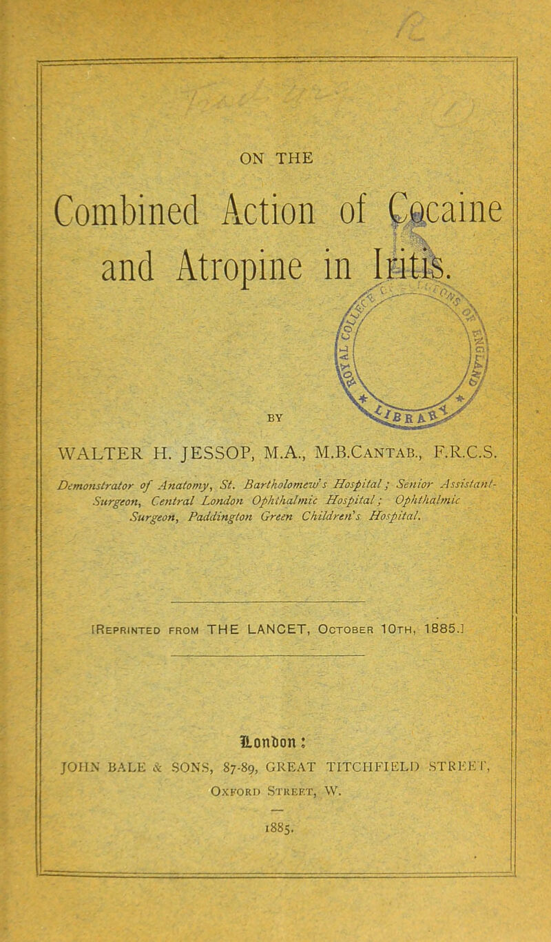 ON THE Combined Action of Ctcaine and Atropine inji^|. BY WALTER H. JESSOP, M.A, M.B.Cantab, F.R.C.S. Demonstrator of Anatomy, St. Bartholomew s Hospital; Senior Assistant- Surgeon, Central London Ophthalmic Hospital; Ophthalmic Surgeon, Paddington Green Children^ Hospital. [Reprinted from THE LANCET, October 10th, 1885.] Eontion: JOII.N BALE & SONS, 87-89, GREAT TITCHFIELI) STRKK I, Oxford Street, W. 1885.