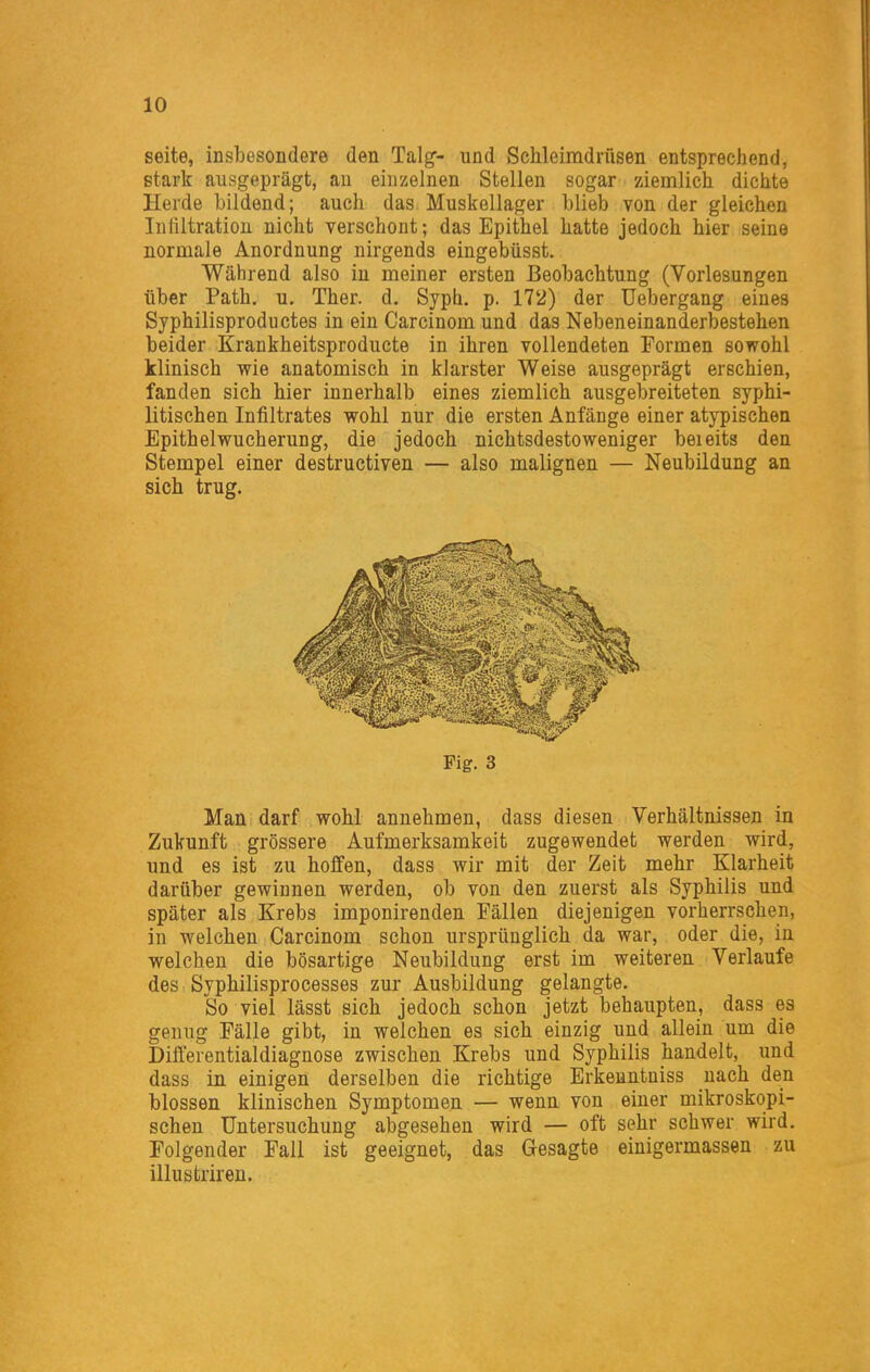 Seite, insbesondere den Talg- und Schleimdrüsen entsprechend, stark ausgeprägt, au einzelnen Stellen sogar ziemlich dichte Herde bildend; auch das Muskellager blieb von der gleichen Inliltration nicht verschont; das Epithel hatte jedoch hier seine normale Anordnung nirgends eingebüsst. Während also in meiner ersten Beobachtung (Vorlesungen über Path. u. Ther. d. Syph. p. 172) der Uebergang eines Syphilisproductes in ein Carcinom und das Nebeneinanderbestehen beider Krankheitsproducte in ihren vollendeten Formen sowohl klinisch wie anatomisch in klarster Weise ausgeprägt erschien, fanden sich hier innerhalb eines ziemlich ausgebreiteten syphi- litischen Infiltrates wohl nur die ersten Anfänge einer atypischen Epithelwucherung, die jedoch nichtsdestoweniger beieits den Stempel einer destructiven — also malignen — Neubildung an sich trug. Fig. 3 Man darf wohl annehmen, dass diesen Verhältnissen in Zukunft grössere Aufmerksamkeit zugewendet werden wird, und es ist zu hoffen, dass wir mit der Zeit mehr Klarheit darüber gewinnen werden, ob von den zuerst als Syphilis und später als Krebs imponirenden Fällen diejenigen vorherrschen, in welchen Carcinom schon ursprünglich da war, oder die, in welchen die bösartige Neubildung erst im weiteren Verlaufe des Syphilisprocesses zur Ausbildung gelangte. So viel lässt sich jedoch schon jetzt behaupten, dass es genug Fälle gibt, in welchen es sich einzig und allein um die Differentialdiagnose zwischen Krebs und Syphilis handelt, und dass in einigen derselben die richtige Erkenntniss nach den blossen klinischen Symptomen — wenn von einer mikroskopi- schen Untersuchung abgesehen wird — oft sehr schwer wird. Folgender Fall ist geeignet, das Gesagte einigermassen zu illustriren.