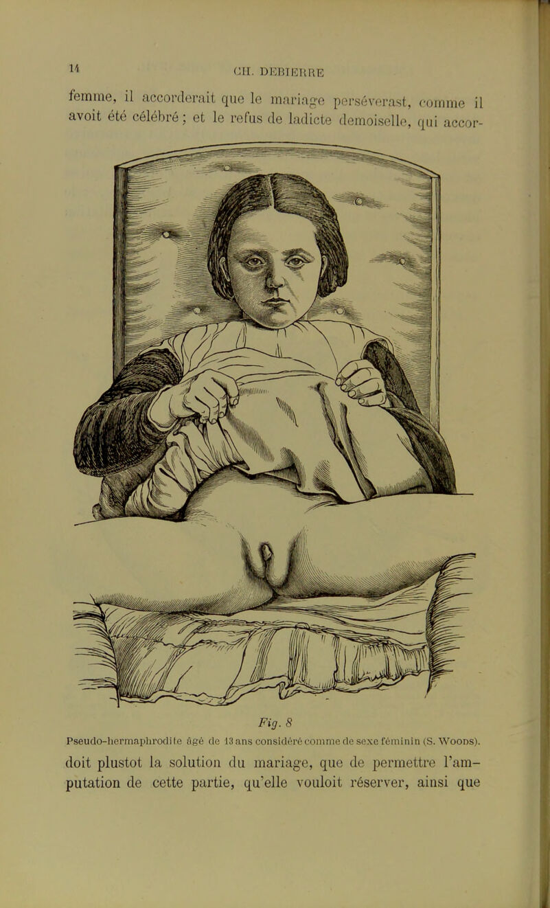 femme, il accorderait que le mariage persévéras!, comme il avoit été célébré; et le refus de ladicte demoiselle, qui accor- Fig. 8 Pseudo-hermaphrodite âgé de 13 ans considéré comme de sexe féminin (S. Woods). doit plustot la solution du mariage, que de permettre l'am- putation de cette partie, qu'elle vouloit réserver, ainsi que