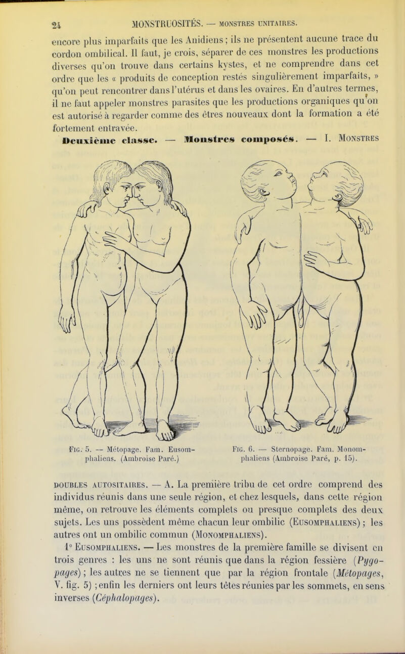 encore plus impai lails que les Auidiens; ils ne présentent aucune trace du cordon ombilical. 11 faut, je crois, séparer de ces monstres les productions diverses qu'on trouve dans certains kystes, et ne comprendre dans cet ordre que les « produits de conception restés singulièrement imparfaits, » qu'on peut rencontrer dans l'utérus et dans les ovaires. En d'autres termes, il ne faut appeler monstres parasites que les productions organiques qu on est autorisé à regarder comme des êtres nouveaux dont la formation a été fortement entravée. Ueuxièuie classe. — Moustrcs composés. — I. Monstres FiG. 5. — Métopage. Fam. Eusom- Fia. 6. — Sternopage. Fam. Monoiii' plialieiis. (Ambroise Paré.) plialiens (Ainbroise Paré, p. 15). DOUBLES AUTOsiTAiREs. — A. La première tribu de cet ordre comprend des individus réunis dans une seule région, et chez lesquels, dans cette région même, on retrouve les éléments complets ou presque complets des deux sujets. Les uns possèdent même chacun leur ombilic (Eusomphaliens) ; les autres ont un ombilic commun (Monomphaliens). 1° Eusomphaliens. — Les monstres de la première famille se divisent en trois genres : les uns ne sont réunis que dans la région fessière [Pygo- pages) ; les autres ne se tiennent que par la région frontale [Métopages, V. fig. 5) ; enfin les derniers ont leurs têtes réunies par les sommets, en sens inverses {Céphalopages).