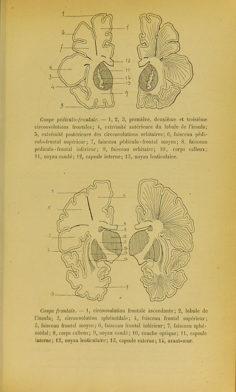 Coupe 2^édiculo-frontale. — 1,2, 3, première,, deuxième et troisième circonvolutions frontales; i, extrémité antérieure du lobule de l'iiisula; 5, extrémité postérieure des circonvolutions orbitaires; 6, faisceau pédi- culo-frontal supérieur; 7, faisceau pédiculo-frontal moyen; 8, faisceau pédicule-frontal inférieur; 9, faisceau orbitaire; 10, corps calleux; 11, noyau caudé; 12, capsule interne; 13, noyau lenticulaire. Coupe frontale. — 1, circonvolution frontale ascendante; 2, lobule de l'insula; 3, circonvolution spliénoïdale; 4., faisceau fronlal supérieur; ô, faisceau fronlal moyor: ; 0, faisceau frontal inférieur; 7, faisceau spbé- noïdal; 8, corps calleux; !), noyau caudé; 10, couche oplirjue; 11, capsule interne; 12, noyau lenticulaire; 13, capsule externe; 14, avanl-mur.