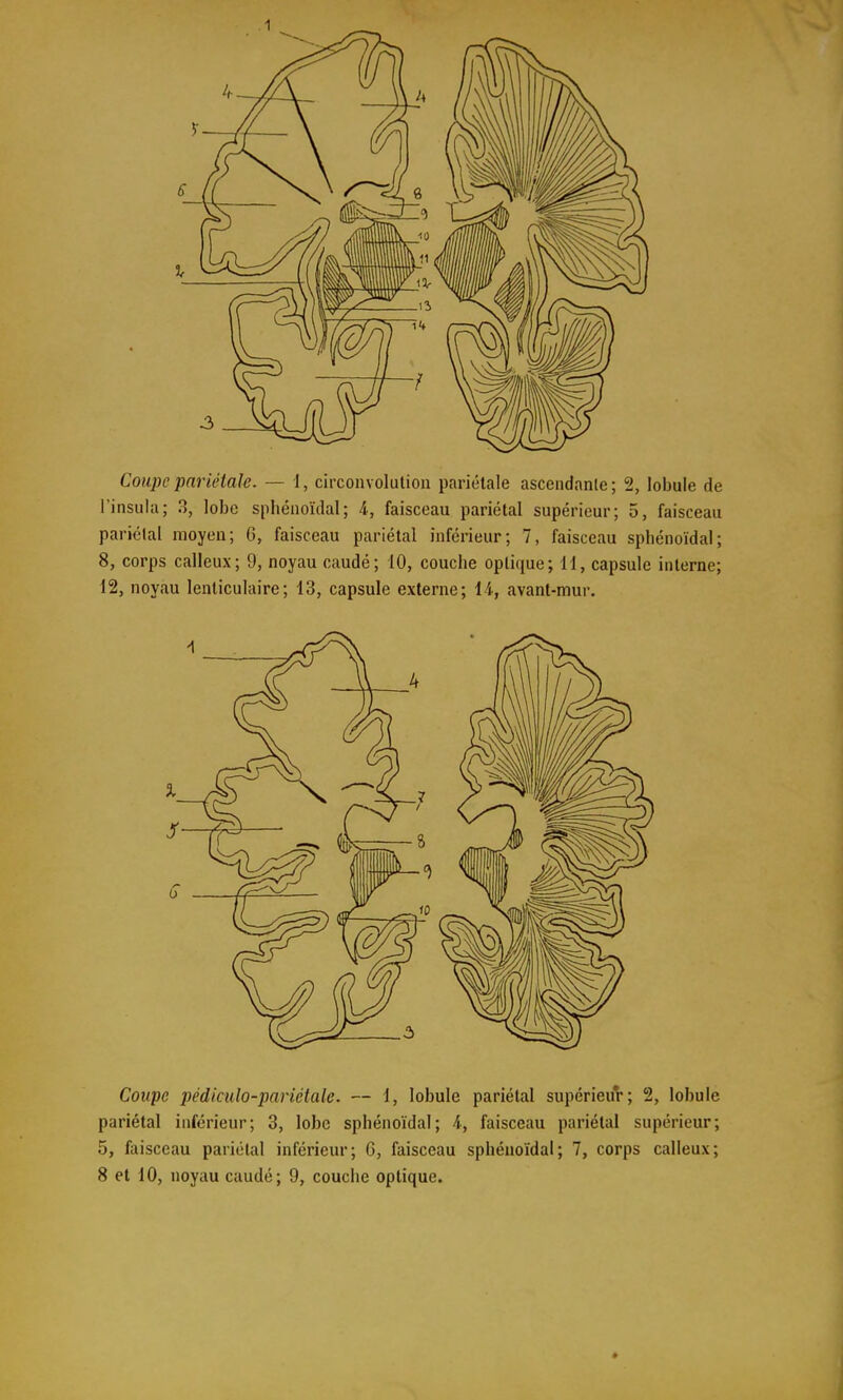 Coupe pariétale. — 1, circonvolution pariétale ascendante; 2, lobule de l'insula; B, lobe spbénoïdal; 4, faisceau pariétal supérieur; 5, faisceau pariétal moyen; G, faisceau pariétal inférieur; 7, faisceau spbénoïdal; 8, corps calleux; 9, noyau caudé; 10, couche optique; 11, capsule interne; 12, noyau lenticulaire; 13, capsule externe; 14, avant-mur. Coupe pédiculo-pariétale. — 1, lobule pariétal supérieur; 2, lobule pariétal inférieur; 3, lobe sphénoïdal; A, faisceau pariétal supérieur; 5, faisceau pariétal inférieur; 6, faisceau sphénoïdal; 7, corps calleux; 8 et 10, noyau caudé; 9, couche optique.