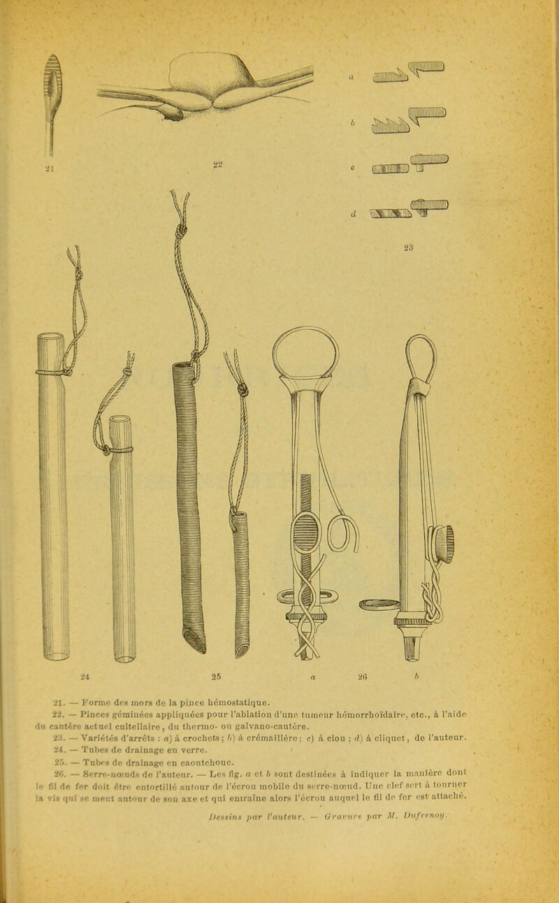 24 25 n 2fl A 21, — Formft des mors de la pince bémostatique. 22, — Pinces géminées appliquées pour l'ablation d'une tumeur hémorrhoïdairc. etc., à l'aide dn cantèrc actuel caltellairc, du tliermo- ou galvnno-cautùre. 23, — Variétés d'arrêts : a) à crochets ; '<) à crémaillère : r) à clou ; d) à cliquet, do l'auteur. 24, — Tobes de drainage en verre. 2,5. — Tabc» de drainage en caontchonc. 2fi. — Serre-nœuds de l'auteur. — Les (ig. a et b sont destinées à indiquer la manière dont le fil de fer doit être entortillé autour de l'écrou mobile du si'rre-nnoud. TJnn clef sert A tourner la vis qui se rneut autour de son axe et qui entraîne alors l'écrou auquel le fil de fer est attache.