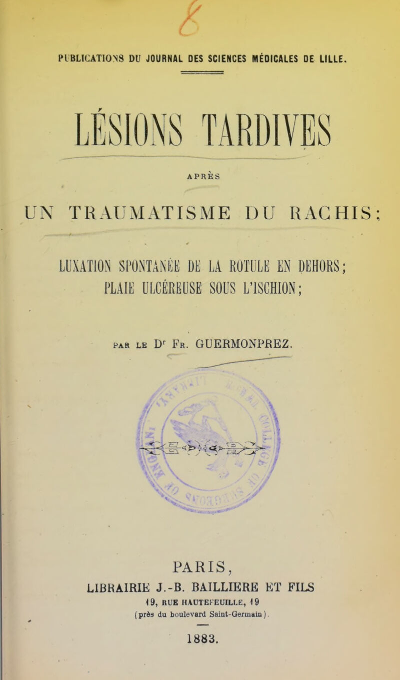 (/ I £ PUBLICATIONS DU JOURNAL DES SCIENCES MÉDICALES DE LILLE. APRÈS UN TRAUMATISME DU RACHIS LUXATION SPONTANÉE DE LA ROTULE EN DEHORS; par le Dr Fr. GUERMONPREZ. PARIS, LIBRAIRIE J.-B. BAILLIERE ET FILS 19, RUE HAUTEKEUILLE, 19 ( près du boulevard Saint-Germain ). 1883.