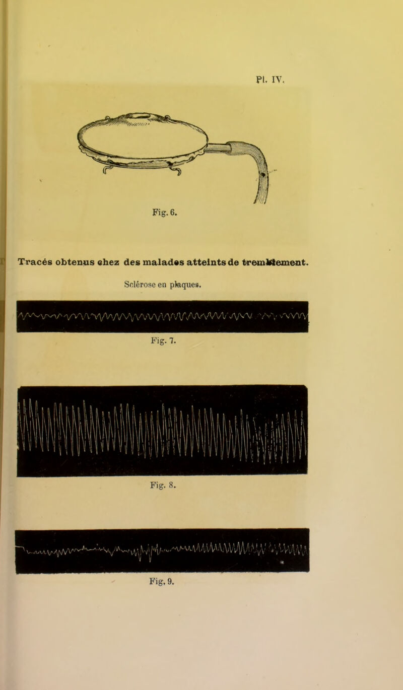 PI. IV. Fig. 6. Traces obtenus ehez des malades atteintsde tremWement. Sclerose en pktques. Fig- 7-