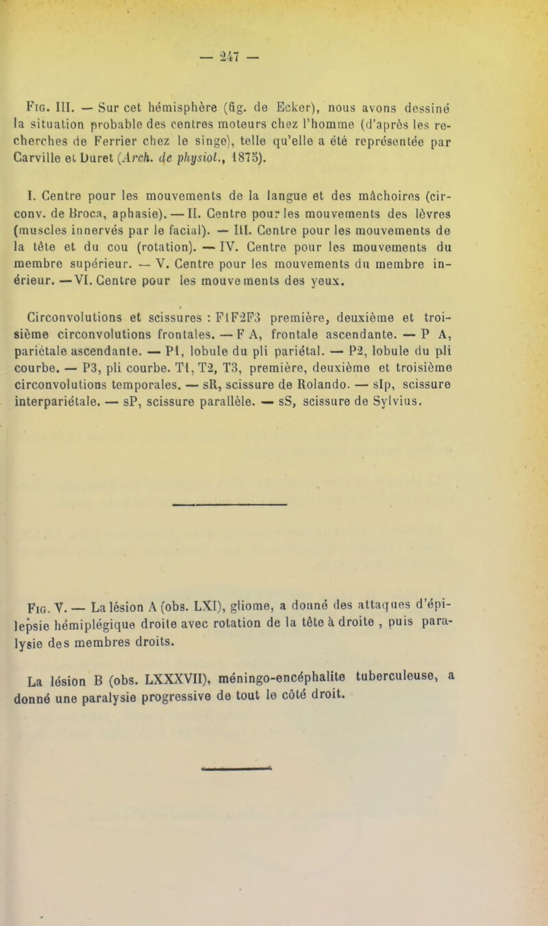 — 247 — Fig. III. — Sur cet hemisphere (fig. de Ecker), nous avons dessine la situation probable des centres moteurs chez I'homme (d'apr^s les re- cherches de Ferrier chez le singe), telle qu'elle a ete representee par Carville et buret (Arch, de physiol., 1875). I. Centre pour les mouvements de la langue et des milchoiros (cir- conv. de Broca, aphasie). — II. Centre pour les mouvements des Ifivres (muscles itinerves par le facial). — III. Centre pour les mouvements de la t^le et du cou (rotation). — IV. Centre pour les mouvements du membre superieur. — V. Centre pour les mouvements du raembre in- ^rieur. —VI, Centre pour les mouvements des yeux. Circonvolutions et scissures : FlFiSPo premiere, deuxieme et troi- sieme circonvolutions frontales. — FA, frontale ascendante. —PA, parietale ascendanle. — PI, lobule du pli parietal. — P2, lobule du pli courbe. — P3, pli courbe. Ti,T2, T3, premiere, deuxieme et troisi^me circonvolutions temporales. — sR, scissure de Rolando. — sip, scissure interparietale. — sP, scissure parallele. — sS, scissure de Sylvius. p,G. V. — La lesion A (obs. LXI), gliome, a donne des attaques d'epi- lepsie hemiplegique droile avec rotation de la tdte a droite , puis para- lysie des membres droits. La Idsion B (obs. LXXXVII), meningo-enc^phalite tuberculeuse, a donne une paralysie progressive de tout le cote droit.