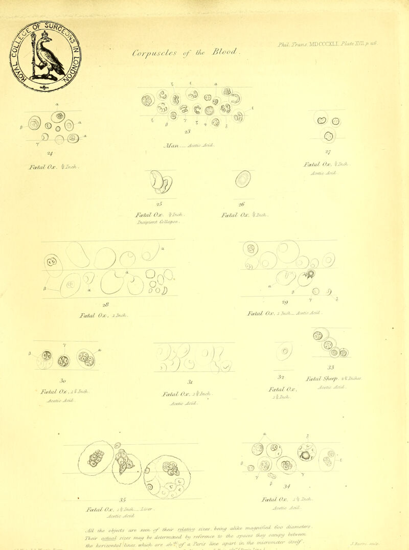 TJal. Transom CCCZLt FlaleHM *6. H Foetal Ox. fyinch ■ Corpuscles of ike Blood. J\£eUV■ _ -Acetic-Adds. 26 26 Foetal Ox. finch . Foetal Ox, %Jnch. iTtpipieOb Collapse.■ © © Q 2? Foetal Ox, klhch,. -AcetCo BLczdC. Foetal Ox, j-lncfo. Foetal Ox. ljnch,—Acetic Acid . 7 3o Foetal Ox, J.%Inch ■ -Acetic-Add. )rj ( ddL Foetal Ox, afylnch _Acetic JLcuL-' 33 Foetal Sheep. 2%Inches. Foetal Ox l a finch,. s -Acetic-AdA dLU, the objects are seen of their retains* sizes, beiny alike TruvcpiiAed 600 chzarveters. Their actual, sipes may be determined by reference to the spaces 1lay occupy between the Tu/rizontal I tines, vdlichs are -ahpof a Tarts tin* apart indie micrometer vtself - j.Sasire. sedp.