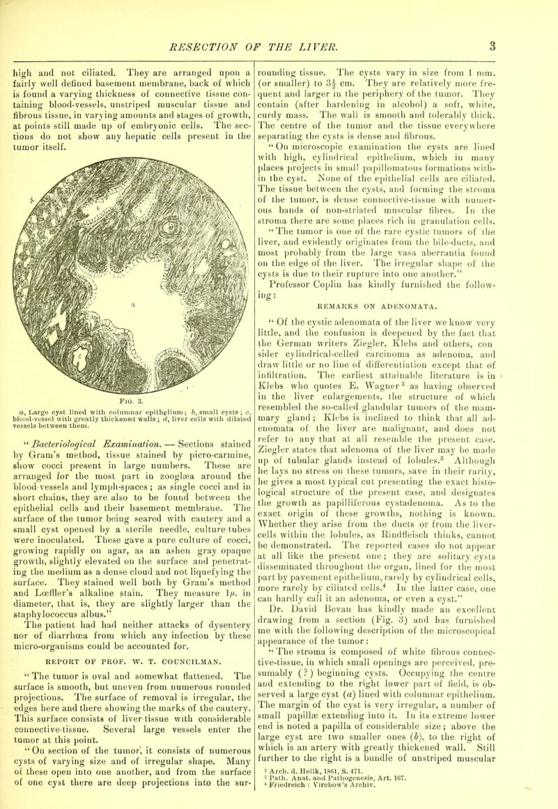 high and not ciliated. They are arranged upon a fairly well defined basement membrane, back of which is found a varying thickness of connective tissue con- taining blood-vessels, unstriped muscular tissue and fibrous tissue, in varying amounts and stages of growth, at points still made up of embryonic cells. The sec- tions do not show any hepatic cells present in the tumor itself. Fig. 3. a, Large cyst lined with columnar epithelium; b, small cysts; c, blood-vessel with greatly thickened walls ; d, liver cells with dilated vessels between them. “ Bacteriological Examination. — Sections stained by Gram’s method, tissue stained by picro-carmine, show cocci present in large numbers. These are arranged for the most part in zooglsea around the blood-vessels and lymph-spaces; as single cocci and in short chains, they are also to be found between the epithelial cells and their basement membraue. The surface of the tumor being seared with cautery and a small cyst opened by a sterile needle, culture-tubes were inoculated. These gave a pure culture of cocci, growing rapidly on agar, as an ashen gray opaque growth, slightly elevated on the surface and penetrat- ing the medium as a dense cloud and not liquefying the surface. They stained well both by Gram’s method and Loeffler’s alkaline stain. They measure \g. in diameter, that is, they are slightly larger than the staphylococcus albus.” The patient had had neither attacks of dysentery nor of diarrhoea from which any infection by these micro-organisms could be accounted for. REPORT OF PROF. W. T. COUNCILMAN. “ The tumor is oval and somewhat flattened. The surface is smooth, but uneven from numerous rounded projections. The surface of removal is irregular, the edges here and there showing the marks of the cautery. This surface consists of liver-tissue with considerable connective-tissue. Several large vessels enter the tumor at this point. “ On section of the tumor', it consists of numerous cysts of varying size and of irregular shape. Many of these open into one another, and from the surface of one cyst there are deep projections into the sur- rounding tissue. The cysts vary in size from 1 mm. (or smaller) to 3^- cm. They are relatively more fre- quent and larger in the periphery of the tumor. They contain (after hardening in alcohol) a soft, white, curdy mass. The wall is smooth and tolerably thick. The centre of the tumor and the tissue everywhere separating the cysts is dense aud fibrous. “ On microscopic examination the cysts are lined with high, cylindrical epithelium, which in many places projects in small papillomatous formations with- in the cyst. None of the epithelial cells are ciliated. The tissue between the cysts, and forming the stroma of the tumor, is dense connective-tissue with numer- ous bands of non-striated muscular fibres. In the stroma there are some places rich in granulation cells. “ The tumor is one of the rare cystic tumors of the liver, and evidently originates from the bile-ducts, aud most probably from the large vasa aberrantia found on the edge of the liver. The irregular shape of the cysts is due to their rupture into one another.” Professor Coplin has kindly furnished the follow- ing: REMARKS ON ADENOMATA. “ Of the cystic adenomata of the liver we know very little, and the confusion is deepened by the fact that the German writers Ziegler, Klebs and others, con sider cylindrical-celled carcinoma as adenoma, and draw little or no line of differentiation except that of infiltration. The earliest attainable literature is in Klebs who quotes E. Wagner2 as having observed in the liver enlargements, the structure of which resembled the so-called glandular tumors of the mam- mary gland; Klebs is inclined to think that all ad- enomata of the liver are malignant, and does not refer to any that at all resemble the present case. Ziegler states that adenoma of the liver may be made up of tubular glands instead of lobules.3 Although he lays no stress on these tumors, save in their rarity, he gives a most typical cut presenting the exact histo- logical structure of the present case, and designates the growth as papilliferous cystadenoma. As to the exact origin of these growths, nothing is known. Whether they arise from the ducts or from the liver- cells within the lobules, as Kindfleisch thinks, cannot be demonstrated. The reported cases do not appear at all like the present one; they are solitary cysts disseminated throughout the organ, lined for the most part by pavement epithelium, rarely by cylindrical cells, more rarely by ciliated cells.4 In the latter case, one can hardly call it an adenoma, or even a cyst.” Dr. David Bevan has kindly made an excellent drawing from a section (Fig. 3) and has furnished me with the following description of the microscopical appearance of the tumor: “ The stroma is composed of white fibrous connec- tive-tissue, in which small openings are perceived, pre- sumably (?) beginning cysts. Occupying the centre and extending to the right lower part of field, is ob- served a large cyst (a) lined with columnar epithelium. The margin of the cyst is very irregular, a number of small papillas extending into it. In its extreme lower end is noted a papilla of considerable size; above the large cyst are two smaller ones (b), to the right of which is an artery with greatly thickened wall. Still further to the right is a bundle of unstriped muscular 2 Arch. d. Heilk, 1861, S. 471. 3 Path. Anat. and Pathogenesis, Art. 167. 4 Friedreich : Virchow’s Archiv.