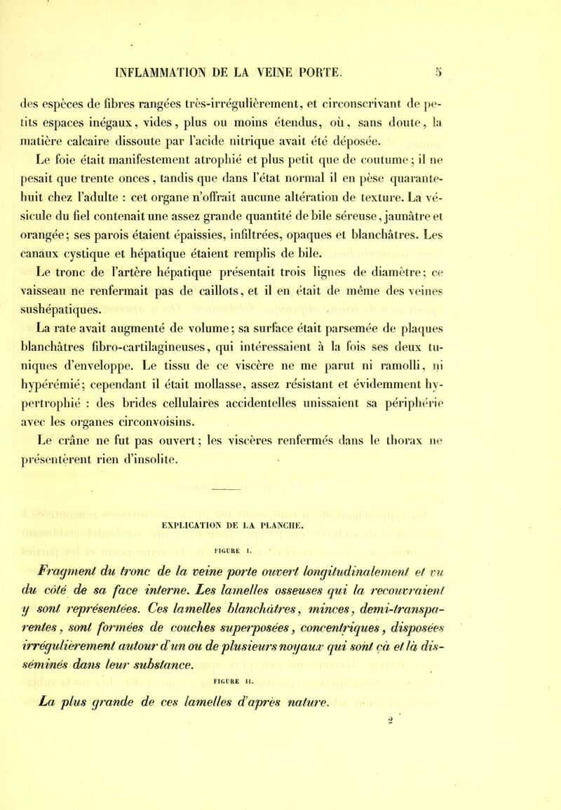 des espèces de fibres rangées très-irrégulièrement, et circonscrivant de pe- tits espaces inégaux, vides, plus ou moins étendus, où, sans doute, la matière calcaire dissoute par l’acide nitrique avait été déposée. Le foie était manifestement atrophié et plus petit que de coutume ; il ne pesait que trente onces , tandis que dans l’état normal il en pèse quarante- huit chez l’adulte : cet organe n’offrait aucune altération de texture. La vé- sicule du fiel contenait une assez grande quantité de bile séreuse, jaunâtre et orangée ; ses parois étaient épaissies, infiltrées, opaques et blanchâtres. Les canaux cystique et hépatique étaient remplis de bile. Le tronc de l’artère hépatique présentait trois lignes de diamètre; ce vaisseau ne renfermait pas de caillots, et il en était de même des veines sushépatiques. La rate avait augmenté de volume ; sa surface était parsemée de plaques blanchâtres fibro-cartilagineuses, qui intéressaient à la fois ses deux tu- niques d’enveloppe. Le tissu de ce viscère ne me parut ni ramolli, ni hypérémié; cependant il était mollasse, assez résistant et évidemment hy- pertrophié : des brides cellulaires accidentelles unissaient sa périphérie avec les organes circonvoisins. Le crâne ne fut pas ouvert ; les viscères renfermés dans le thorax ne présentèrent rien d’insolite. EXPLICATION DE LA PLANCHE. FIGURE 1. Fragment du tronc de la veine porte ouvert longitudinalement et vu du côté de sa face interne. Les lamelles osseuses qui la recouvraient y sont représentées. Ces lamelles blanchâtres, minces, demi-transpa- rentes, sont formées de couches superposées, concentriques, disposées irrégulièrement autour dun ou de plusieurs noyaux qui sont ça et là dis- séminés dans leur substance. FIGURE II. La plus grande de ces lamelles d’après nature.