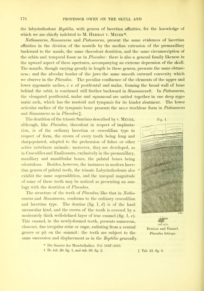 the labyrinthodont Reptilia, with genera of lacertian affinities, for the knowledge of which we are chiefly indebted to M. Herman v. Meyer*. Nothosaurus, Simosaurus and Pistosaurus, present the same evidences of lacertian affinities in the division of the nostrils by the median extension of the premaxillary backward to the nasals, the same thecodont dentition, and the same circumscription of the orbits and temporal fossae as in Placodus: there is also a general family likeness in the upward aspect of these apertures, accompanying an extreme depression of the skull. The muzzle, though varying greatly in length in these genera, presents the same obtuse- ness ; and the alveolar border of the jaws the same smooth outward convexity which we observe in the Placodus. The peculiar confluence of the elements of the upper and lower zygomatic arches, i. e. of postfrontal and malar, forming the broad wall of bone behind the orbit, is continued still further backward in Simosaurus^. In Pistosaurus, the elongated postfrontal, malar and squamosal are united together in one deep zygo- matic arch, which has the mastoid and tympanic for its hinder abutment. The lower articular surface of the tympanic bone presents the same trochlear form in Pistosaurus and Simosaurus as in Placodus%. The dentition of the triassic Saurians described by v. Meyer, although, like Placodus, thecodont in respect of implanta- tion, is of the ordinary lacertian or crocodilian type in respect of form, the crown of every tooth being long and sharp-pointed, adapted to the prehension of fishes or other active vertebrate animals: moreover, they are developed, as in Crocodiles and Enaliosaurs, exclusively in the premaxillary, maxillary and mandibular bones, the palatal bones being edentulous. Besides, however, the instances in modern lacer- tian genera of palatal teeth, the triassic Labyrinthodonts also exhibit the same superaddition, and the unequal magnitude of some of these teeth may be noticed as presenting an ana- logy with the dentition of Placodus. The structure of the teeth of Placodus, like that in Notho- saurus and Simosaurus, conforms to the ordinary crocodilian and lacertian type. The dentine (fig. 1, d) is of the hard unvascular kind, and the crown of the tooth is covered by a moderately thick well-defined layer of true enamel (fig. 1, e). This enamel, in the newly-formed tooth, presents numerous, close-set, fine irregular striae or rugae, radiating from a central groove or pit on the summit: the teeth are subject to the same succession and displacement as in the Reptilia generally. * Die Saurier dea Muschelkalkes. Fol. 1847-1855. f lb. tab. 20. fig. 1, and tab. 65. fig. 2. ; nat. size. Dentine and Enamel, Placodus laticeps. Tab. 21. fig. 3.