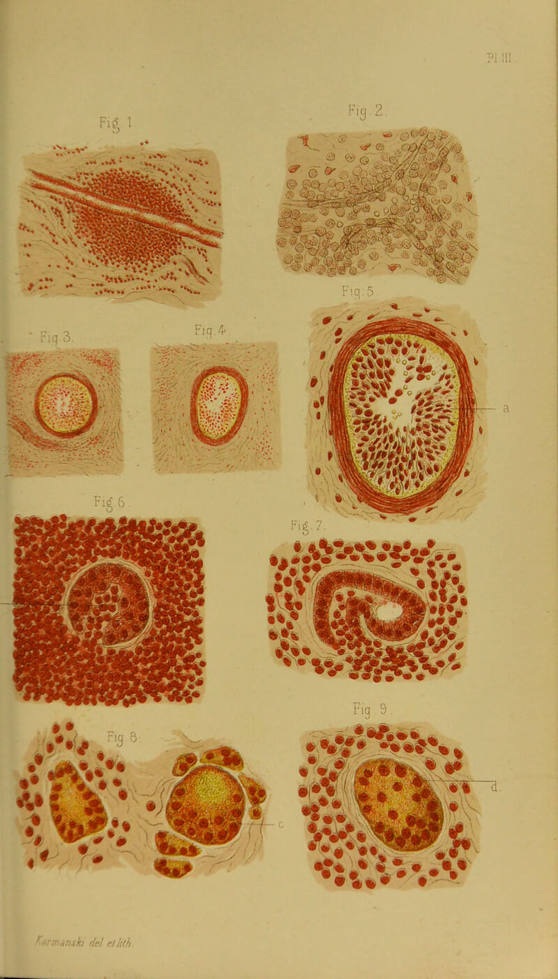 'trmansh Hcl e.lltth