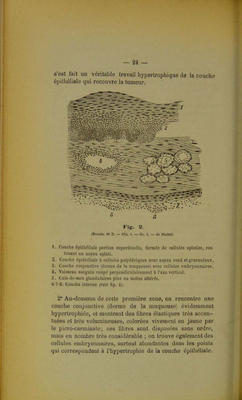 s'est fait un véritable travail hypertrophique de la couche épithéliale qui recouvre la tumeur. Fig. 2. (SrosBis. 80 D. — Obj, 1. — Oc. I. — de Naohot) 1. Couche épithéliale portion superficielle, formée de cellules aplaties, con tenant un noyau aplati. 2. Couche épithéliale à cellules polyédriques avec noyau rond etgrannuleux. 3. Couche conjonctive (derme de la muqueuse) avec cellules embryonnaires. 4. Vaisseau sanguin coupé perpendiculairement à l'axe vertical. 5. Culs-dc-sacs glandulaires plus ou moins altérés. 6-7-8. Couche interne (voir fig. 4). 2 Au-dessous de cette première zone, on rencontre une couche conjonctive (derme de la muqueuse) évidemment hypertrophiée, et montrant des fibres élastiques très accen- tuées et très volumineuses, colorées vivement en jaune par le picro-carminate; ces fibres sont disposées sans ordre, mais en nombre très considérable ; on trouve également des cellules embryonnaires, surtout abondantes dans les points qui correspondent à l'hyperlrophie de la couche épithéliale.