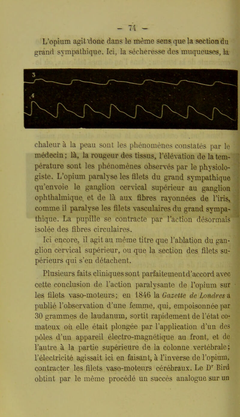 L'opium agit\1onc dans le même sens que la section du grand sympathique. Ici, la sécheresse des muqueuses, la chaleur à la peau sout les phénomènes constatés par le médecin ; là, la rougeur des tissus, l'élévation de la tem- pérature sont les phénomènes observés par le physiolo- giste. L'opium paralyse les filets du grand symi.xithiquo qu'envoie le ganglion cervical supérieur au ganglion ophthalmique et de là aux fibres rayonnées de l'iris, comme il paialyse les filets vasculaires du grand sympa- thique. La pupille se contracte par Faction désormais isolée des fibres circulaires. Ici encore, il agit au même titre que l'ablation du gan- glion cervical supérieur, ou que la section des filets su- périeurs qui s'en détachent. Plusieurs faits cliniques sont parfaitementd'accoM avec cette conclusion de l'action paralysante de l'opium sur les filets vaso-moteurs; eu 1846 la Gazette de Londres a publié l'observation d'une femme, qui, empoisonnée par 30 grammes de laudanum, sortit rapidement de l état co- mateux où elle était plongée par l'application d'un des pôles d'un appareil électro-magnétique au front, et de l'autre à la partie supérieure de la colonne vertébrale; réleclricité agissait ici en faisant, à l'inverse de l'opium, contracter les filets vaso-moteurs cérébraux. Le D Bird obtint par le même procédé un succès analogue sur un
