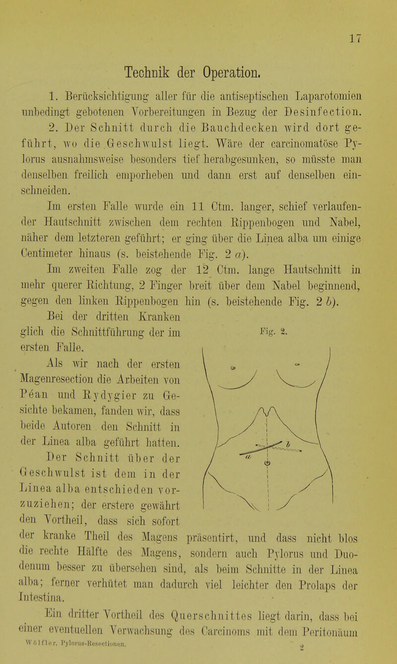 Technik der Operation. 1. Berücksichtigung aller für die antiseptischen Laparotomien unbedingt gebotenen Vorbereitungen in Bezug der Desinfection. 2. Der Schnitt durch die Bauchdecken wird dort ge- führt, wo die Geschwulst liegt. Wäre der carcinomatöse Py- lorus ausnahmsweise besonders tief herabgesunken, so müsste man denselben freilich emporheben und dann erst auf denselben ein- schneiden. Im ersten Falle wurde ein 11 Ctm. langer, schief verlauf en- der Hautschnitt zwischen dem rechten Rippenbogen und Nabel, näher dem letzteren geführt; er ging über die Linea alba um einige Centimeter hinaus (s. beistehende Fig. 2 a). Im zweiten Falle zog der 12 Ctm. lange Hautschnitt in mehr querer Eichtling, 2 Finger breit über dem Nabel beginnend, gegen den linken Rippenbogen hin (s. beistehende Fig. 2 b). Bei der dritten Kranken glich die Schnittführung der im ersten Falle. Als wir nach der ersten Magenresection die Arbeiten von Pean und Bydygier zu Ge- sichte bekamen, fanden wir, dass beide Autoren den Schnitt in der Linea alba geführt hatten. Der Schnitt über der Geschwulst ist dem in der Linea alba entschieden vor- zuziehen; der erstere gewährt den Vortheil, dass sich sofort der kranke Theil des Magens die rechte Hälfte des Fig. 2. Magens. präsentirt, und dass nicht blos sondern auch Pylorus und Duo- denum besser zu übersehen sind, als beim Schnitte in der Linea alba; ferner verhütet man dadurch viel leichter den Prolaps der [ntestina. Lin dritter Vortheil des Querschnittes liegt darin, dass bei einer eventuellen Verwachsung des Carcinoma mit dein Peritonäuin W ö ] fl o r. PyloruH-Hi.'socIioiKjn. ,,