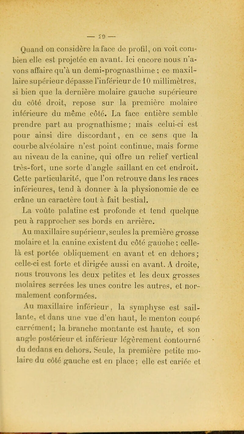 £9 Quand ou considère la face de jDrofil, on voit com- bien elle est projetée en avant. Ici encore nous n’a- vons affaire qu’à un demi-prog’iiasthirne ; ce maxil- laire supérieur dépasse l’inférieur de 10 millimètres, si bien que la dernière molaire g-auche supérieure du côté droit, repose sur la première molaire inférieure du même côté. La face entière semble prendre part au prog’nathisme ; mais celui-ci est pour ainsi dire discordant, en ce sens que la courbe alvéolaire n’est point continue, mais forme au niveau de la canine, qui offre un relief vertical très-fort, une sorte d’ang'le saillant en cet endroit. Cette particularité, que l’on retrouve dans les races inférieures, tend à donner à la physionomie de ce crâne un caractère tout à fait bestial. La voûte palatine est profonde et tend quelque peu à rapprocher ses bords en arrière. Au maxillaire supérieur, seules la première g*rosse molaire et la canine existent du côté g’auohe ; celle- là est portée obliquement en avant et en dehors ; celle-ci est forte et dirig-ée aussi en avant. A droite, nous trouvons les deux petites et les deux g-rosses molaires serrées les unes contre les autres, et nor- malement conformées. Au maxillaire inférieur, la symphyse est sail- lante, et dans une vue d’en haut, le menton coupé carrément; la branche montante est haute, et son ang*le postérieur et inférieur légèrement contourné du dedans en dehors. Seule, la première petite mo- laire du côté g-auche est en place; elle est cariée et