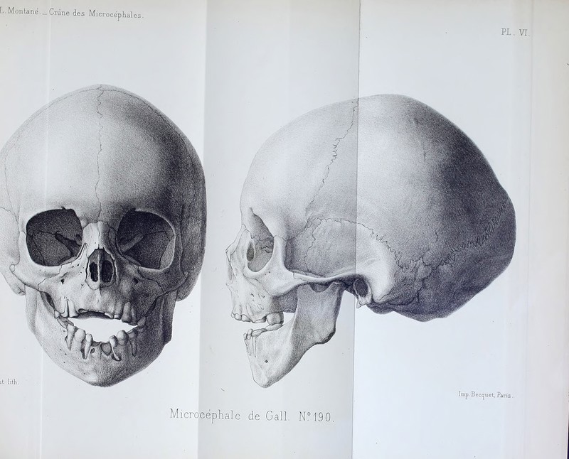PL. Microcéphale de Gall, NM90. Imp.Beccjuel, Paris. il lith.