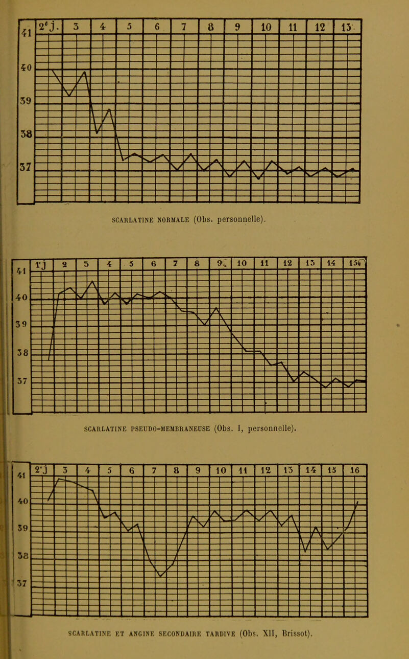 2'J 41 40 39 38 37 4 a 9 10 11 12 15 SZ SCARLATINE NORMALE (Obs. personnelle). SCARLATINE PSEUDO-MEMBRANEUSE (Obs. I, personnelle). 41 40 59 3S 37 2'J 8 10 il 12 15 14 15 16 lis 55 E :5 SCARLATINE ET ANGINE SECONDAIRE TARDIVE (Obs. XII, lîrisSOl).