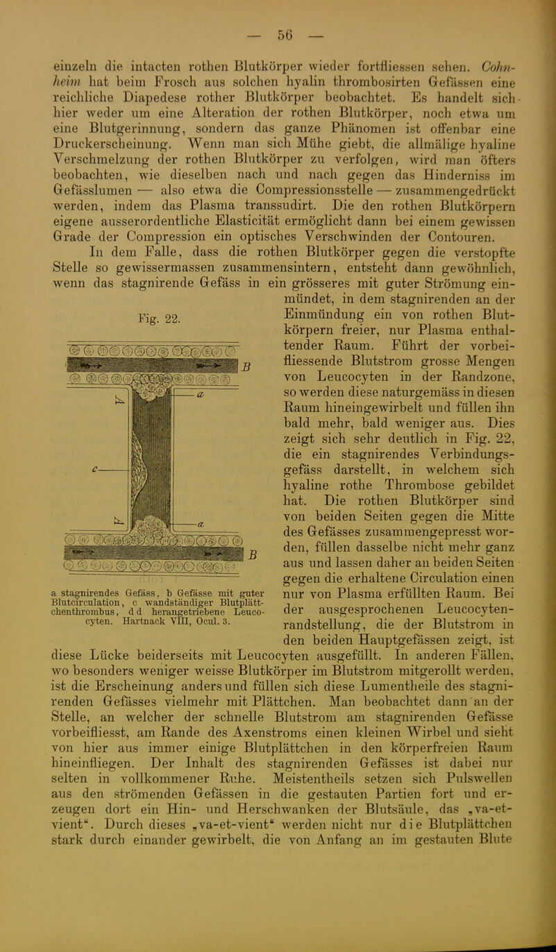 Fig. 22. einzeln die iutacten rothen Blutkörper wieder fortfliessen sehen. Cohn- heim hat beim Frosch aus solchen hyalin thrombosirten Gelassen eine reichliche Diapedese rother Blutkörper beobachtet. Es handelt sich- hier Aveder um eine Alteration der rothen Blutkörper, noch etwa um eine Blutgerinnung, sondern das ganze Phänomen ist offenbar eine Druckerscheinung. Wenn man sich Mühe giebt, die allmälige hyaline Verschmelzung der rothen Blutkörper zu verfolgen, wird man öfters beobachten, wie dieselben nach und nach gegen das Hinderniss im Gefasslumen — also etwa die Compressionsstelle — zusammengedrückt werden, indem das Plasma transsudirt. Die den rothen Blutkörpern eigene ausserordentliche Elasticität ermöglicht dann bei einem gewissen Grade der Compression ein optisches Verschwinden der Contouren. In dem Falle, dass die rothen Blutkörper gegen die verstopfte Stelle so gewissermassen zusammensintern, entsteht dann gewöhnlich, wenn das stagnirende Gefäss in ein grösseres mit guter Strömung ein- mündet, in dem stagnirenden an der Einmündung ein von rothen Blut- körpern freier, nur Plasma enthal- tender Raum. Führt der vorbei- fliessende Blutstrom grosse Mengen von Leucocyten in der Randzone, so werden diese naturgemäss in diesen Raum hin ein gewirbelt und füllen ihn bald mehr, bald weniger aus. Dies zeigt sich sehr deutlich in Fig. 22, die ein stagnirendes Verbindungs- gefäss darstellt, in welchem sich hyaline rothe Thrombose gebildet hat. Die rothen Blutkörper sind von beiden Seiten gegen die Mitte des Gefässes zusamraengepresst wor- den, füllen dasselbe nicht mehr ganz aus und lassen daher au beiden Seiten gegen die erhaltene Circulation einen nur von Plasma erfüllten Raum. Bei der ausgesprochenen Leucocyten- randstellung, die der Blutstrom in den beiden Hauptgefässen zeigt, ist diese Lücke beiderseits mit Leucocyten ausgefüllt. In anderen Fällen, wo besonders weniger weisse Blutkörper im Blutstrom mitgerollt werden, ist die Erscheinung anders und füllen sich diese Lumentlieile des stagni- renden Gefässes vielmehr mit Plättchen. Man beobachtet dann an der Stelle, an welcher der schnelle Blutstrom am stagnirenden Gefässe vorbeifliesst, am Rande des Axenstroms einen kleinen Wirbel und sieht von hier aus immer einige Blutplättchen in den körperfreien Raum hineinfliegen. Der Inhalt des stagnirenden Gefässes ist dabei nur selten in vollkommener Ruhe. Meistentheils setzen sich Pulswellen aus den strömenden Gefässen in die gestauten Partien fort und er- zeugen dort ein Hin- und Herschwanken der Blutsäule, das „va-et- vient. Durch dieses „va-et-vient werden nicht nur die Blutplättchen stark durch einander gewirbelt, die von Anfang an im gestauten Blute ©fejOOO,(5)'.0(<^ a stagnirendes G-efäss, b Gefässe mit guter Blutcirculation, c wandständiger Blutplätt- chenthrombus , d d herangetriebene Leuco- cyten. Hartnack VIII, Ocul. 3.