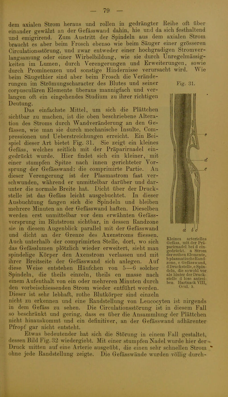 Fig. 31. dem axialen Strom heraus und rollen in gedrängter Reihe oft über einander gewälzt an der Gefässwand dahin, hie und da sieh festhaltend und emigrirend. Zum Austritt der Spindeln aus dem axialen Strom braucht es aber beim Frosch ebenso wie beim Säuger einer grösseren Circulatiousstörung, und zwar entweder einer hochgradigen Stromver- langsamung oder einer Wirbelbildung, wie sie durch Unregelmässig- keiten im Lumen, durch Verengerungen und Erweiterungen, sowie durch Prominenzen und sonstige Hindernisse verursacht wird. Wie beim Säuiyethier sind aber beim Frosch die Verände- runo-en im Strömungscharacter des Blutes und semer corpusculären Elemente überaus mannigfach und ver- langen oft ein eingehendes Studium zu ihrer richtigen Deutung. Das einfachste Mittel, um sich die Plättchen sichtbar zu machen, ist die oben beschriebene Altera- tion des Stroms durch Wand Veränderung an den Ge- fässen, wie man sie durch mechanische Insulte, Com- pressionen und Ueberstreichungen erreicht. Ein Bei- spiel dieser Art bietet Fig. 31. Sie zeigt ein kleines Gefäss, welches seitlich mit der Präparirnadel ein- gedrückt wurde. Hier findet sich ein kleiner, mit einer stumpfen Spitze nach innen gerichteter Vor- sprung der Gefässwand: die comprimirte Partie. An dieser Verengerung ist der Plasmastrom fast ver- schwunden, während er unmittelbar darüber und dar- unter die normale Breite hat. Dicht über der Druck- stelle ist das Gefäss leicht ausgebuchtet. In dieser Ausbuchtung fangen sich die Spindeln und bleiben mehrere Minuten an der Gefässwand haften. Dieselben werden erst unmittelbar vor dem erwähnten Gefäss- vorsprung im Blutstrom sichtbar, in dessen Randzone sie in diesem Augenblick parallel mit der Gefässwand und dicht an der Grenze des Axenstroms fliessen. Auch unterhalb der comprimirten Stelle, dort, wo sich das Gefässluraen plötzlich wieder erweitert, sieht man spindelige Körper den Axenstrom verlassen und mit ihrer Breitseite der Gefässwand sich anlegen. Auf diese Weise entstehen Häufchen von 5—6 solcher Spindeln, die theils einzeln, theils en masse nach einem Aufenthalt von ein oder mehreren Minuten durch den vorbeischiessenden Strom wieder entführt werden. Dieser ist sehr lebhaft, rothe Blutkörper sind einzeln nicht zu erkennen und eine Randstellung von Leucocyten ist nirgends in dem Gefäss zu sehen. Die Circulationsstörung ist in diesem Fall so beschränkt und gering, dass es über die Ansammlung der Plättchen nicht hinauskommt und ein definitiver, an der Gefässwand adhärenter Pfropf gar nicht entsteht. Etwas bedeutender hat sich die Störung in einem Fall gestaltet, dessen Bild Fig. 32 wiedergiebt. Mit einer stumpfen Nadel wurde hier der» Druck mitten auf eine Arterie ausgeübt, die einen sehr schnellen Strom  ohne jede Randstellung zeigte. Die Gefässwände wurden völlig durch- Kleines arterielles Gefäss, mit der Prä- parirnadel bei d ein- gedrückt, a Strom derrothen Elemente, b plasmatischeRand- zone, c Gefässwand, d Druck stelle, e Spin- deln, die sowohl vor als liinter der Druck- stelle d lose antrei- ben. Hartnack VIII, Ocul. 3.