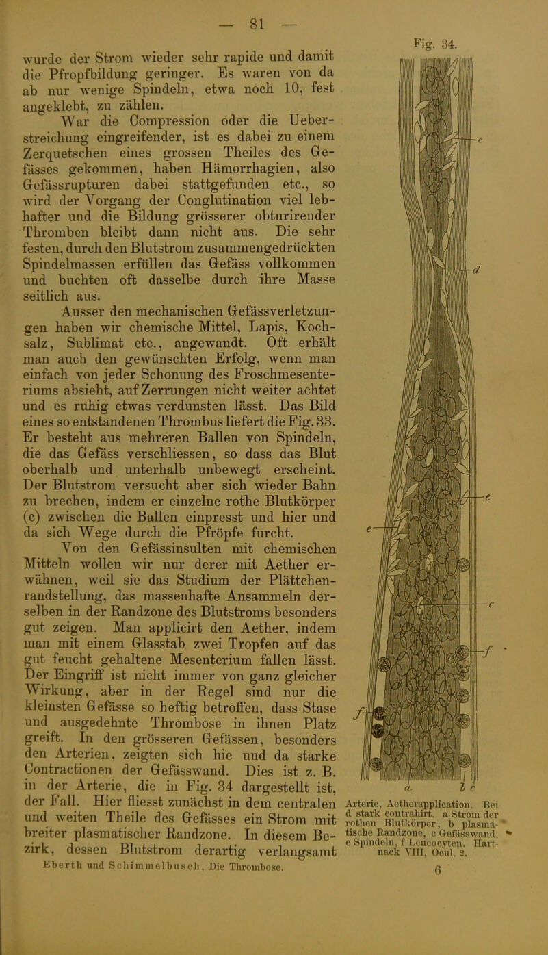wurde der Strom wieder sehr rapide und damit die Pfropfbildung geringer. Es waren von da ab nur wenige Spindeln, etwa nocli 10, fest angeklebt, zu zählen. War die Compression oder die Ueber- streichung eingreifender, ist es dabei zu einem Zerquetschen eines grossen Theiles des Ge- fasses gekommen, haben Hämorrhagien, also Gefässrupturen dabei stattgefunden etc., so wird der Vorgang der Conglutination viel leb- hafter und die Bildung grösserer obturireuder Thromben bleibt dann nicht aus. Die sehr festen, durch den Blutstrom zusammengedrückten Spindelraassen erfüllen das Gefäss vollkommen und buchten oft dasselbe durch ihre Masse seitlich aus. Ausser den mechanischen Gefässverletzun- gen haben wir chemische Mittel, Lapis, Koch- salz, Sublimat etc., angewandt. Oft erhält man auch den gewünschten Erfolg, wenn man einfach von jeder Schonung des Froschmesente- riums absieht, auf Zerrungen nicht weiter achtet und es ruhig etwas verdunsten lässt. Das Bild eines so entstandenen Thrombus liefert die Fig. 33. Er besteht aus mehreren Ballen von Spindeln, die das Gefäss verschliessen, so dass das Blut oberhalb und unterhalb unbewegt erscheint. Der Blutstrom versucht aber sich wieder Bahn zu brechen, indem er einzelne rothe Blutkörper (c) zwischen die Ballen einpresst und hier und da sich Wege durch die Pfröpfe furcht. Von den Gefässinsulten mit chemischen Mitteln wollen wir nur derer mit Aether er- wähnen, weil sie das Studium der Plättchen- randstellung, das massenhafte Ansammeln der- selben in der Randzone des Blutstroms besonders gut zeigen. Man applicirt den Aether, indem man mit einem Glasstab zwei Tropfen auf das gut feucht gehaltene Mesenterium fallen lässt. Der Eingriff ist nicht immer von ganz gleicher Wirkung, aber in der Regel sind nur die kleinsten Gefässe so heftig betroffen, dass Stase und ausgedehnte Thrombose in ihnen Platz greift. In den grösseren Gefässen, besonders den Arterien, zeigten sich hie und da starke Contractionen der Gefässwand. Dies ist z. B. in der Arterie, die in Fig. 34 dargestellt ist, der Fall. Hier fliesst zunächst in dem centralen und weiten Theile des Gefässes ein Strom mit breiter plasmatischer Randzone. In diesem Be- zirk, dessen Blutstrom derartig verlangsamt Eberth und Scliimmelbnsoli, Die Thrombose. e — Fig. 34. f Arterie, Aetherapplication. Bei d stark contrahirt. a Strom der rothen Blutkörper, b plasma-' tische Raudzone, c Gefässwand. e Spindeln, f Leucocyten. Hart- nack VIII, Oöul. 2.