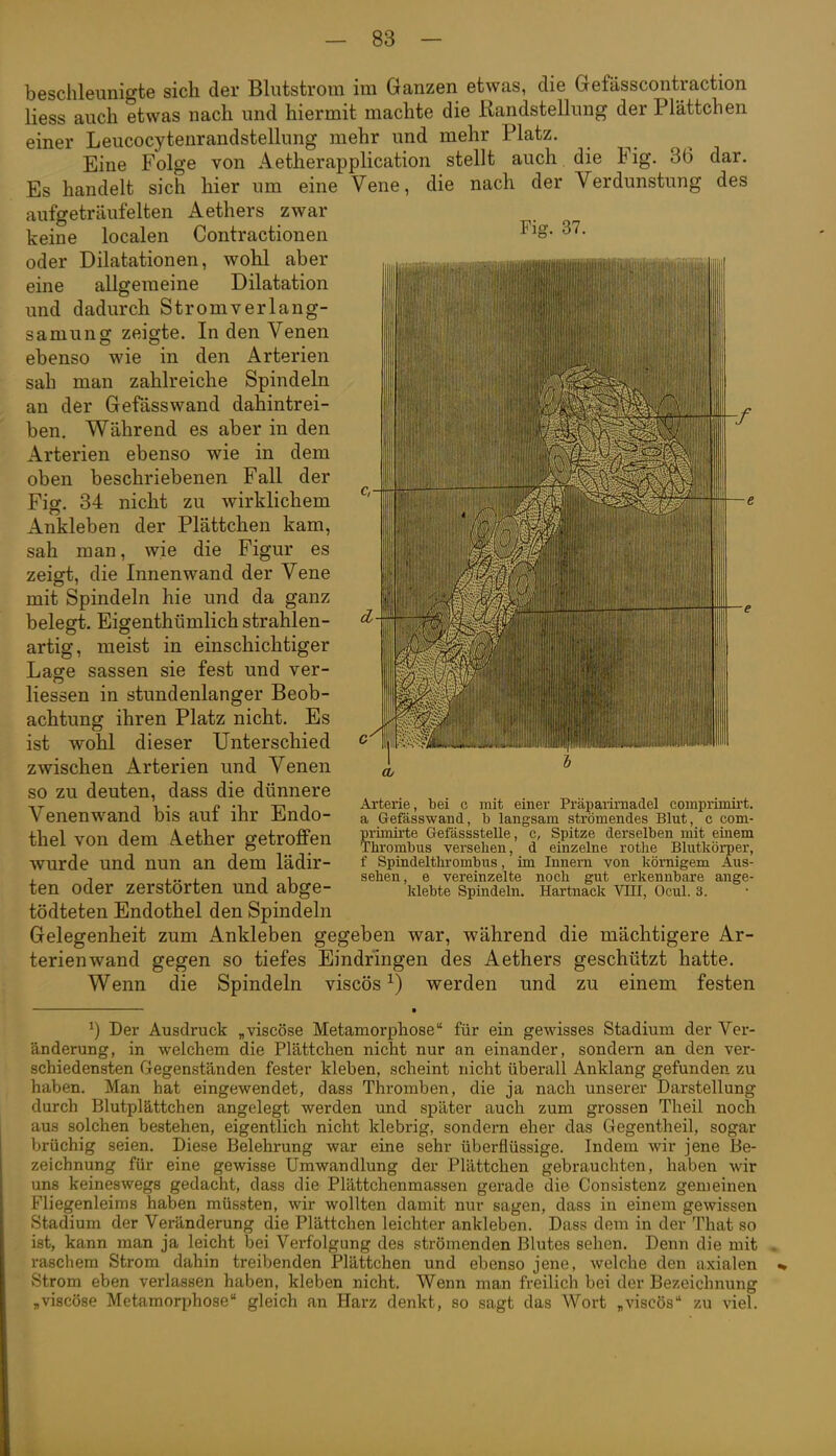 Fig. 37. beschleunigte sich der Blutstrom im Ganzen etwas, die Gefässcontraction Hess auch etwas nach und hiermit machte die liandstellung der Plättchen einer Leucocytenrandstellung mehr und mehr Platz. Eine Folge von Aetherapplication stellt auch die Fig. 36 dar. Es handelt sich hier um eine Vene, die nach der Verdunstung des aufgeträufelten Aethers zwar keine localen Contractionen oder Dilatationen, wohl aber eine allgemeine Dilatation und dadurch Stromverlang- samung zeigte. In den Venen ebenso wie in den Arterien sah man zahlreiche Spindeln an der Gefässwand dahintrei- ben. Während es aber in den Arterien ebenso wie in dem oben beschriebenen Fall der Fig. 34 nicht zu wirklichem Ankleben der Plättchen kam, sah man, wie die Figur es zeigt, die Innenwand der Vene mit Spindeln hie und da ganz belegt. Eigenthümlich strahlen- artig, meist in einschichtiger Lage Sassen sie fest und ver- Hessen in stundenlanger Beob- achtung ihren Platz nicht. Es ist wohl dieser Unterschied zwischen Arterien und Venen so zu deuten, dass die dünnere Venenwand bis auf ihr Endo- thel von dem Aether getroffen wurde und nun an dem lädir- ten oder zerstörten und abge- tödteten Endothel den Spindeln Gelegenheit zum Ankleben gegeben war, während die mächtigere Ar- terienwand gegen so tiefes Eindringen des Aethers geschützt hatte. Wenn die Spindeln viscös ^) werden und zu einem festen Arterie, bei c mit einer Präpaiimadel comprimirt. a Gefässwand, b langsam strömendes Blut, c com- primirte Gefässstelle, c, Spitze derselben mit eiaem Thrombus versehen, d einzelne rothe Blutkörper, f Spindelthrombus, im Innern von körnigem Aus- sehen, e vereinzelte noch gut erkennbare ange- klebte Spindeln. Hartnack VUI, Ocul. 3. ^) Der Ausdruck „viscöse Metamorphose für ein geviüsses Stadium der Ver- änderung, in welchem die Plättchen nicht nur an einander, sondern an den ver- schiedensten Gegenständen fester kleben, scheint nicht überall Anklang gefunden zu haben. Man hat eingev?endet, dass Thromben, die ja nach unserer Darstellung durch Blutplättchen angelegt werden und später auch zum grossen Theil noch aus solchen bestehen, eigentlich nicht klebrig, sondern eher das Gegentheil, sogar Ijrüchig seien. Diese Belehrung war eine sehr überflüssige. Indem wir jene Be- zeichnung für eine gewisse Umwandlung der Plättchen gebrauchten, haben wir uns keineswegs gedacht, dass die Plättchenmassen gerade die Consistenz gemeinen Fliegenleims haben müssten, wir wollten damit nur sagen, dass in einem gewissen Stadium der Veränderung die Plättchen leichter ankleben. Dass dem in der That so ist, kann man ja leicht bei Verfolgung des strömenden Blutes sehen. Denn die mit raschem Strom dahin treibenden Plättchen und ebenso jene, welche den axialen Strom eben verlassen haben, kleben nicht. Wenn man freilich bei der Bezeichnung „viscöse Metamorphose gleich an Harz denkt, so sagt das Wort „viscös zu viel.
