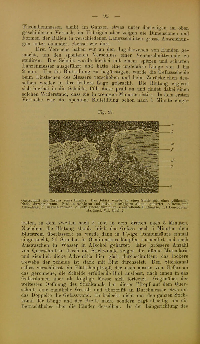 Thrombenmassen bleibt im Ganzen etwas unter derjenigen im oben geschilderten Versuch, im Uebrigen aber zeigen die Dimensionen und Formen der Ballen in verschiedenen Längsschnitten grosse Abweichun- gen unter einander, ebenso wie dort. Drei Versuche haben wir an den Jugularvenen von Hunden ge- macht, um den spontanen Verschluss einer Venenschnittwunde zu studiren. Der Schnitt wurde hierbei mit einem spitzen und scharfen Lanzenmesser ausgeführt und hatte eine ungefähre Länge von 1 bis 2 mm. Um die Blutstillung zu begünstigen, wurde die Grefässscheide beim Einstechen des Messers verschoben und beim Zurückziehen des- selben wieder in ihre frühere Lage gebracht. Die Blutung ergiesst sich hierbei in die Scheide, füllt diese prall an und findet dabei einen solchen Widerstand, dass sie in wenigen Minuten sistirt. In dem ersten Versuche war die spontane Blutstillung schon nach 1 Minute einge- Fig. 39. Querscbnitt der Carotis eines Hundes. Das Gefäss wurde au einer Stelle mit einer glühenden Nadel durchgebrannt. Erst in eoo/oigem und später in 900/oigem Alkohol gehärtet, a Media und Adventitia, b Elastica intimae, c Blutplättchenthromben, e ausfüllende Blutmasse, d. f Leucocyten. Hartnack Vn, Ocul. 2. treten, in dem zweiten nach 2 und in dem dritten nach 5 Minuten, Nachdem die Blutung stand, blieb das Gefäss noch 5 Minuten dem Blutstrom überlassen; es wurde dann in P/o ige Osmiumsäure einmal eingetaucht, 36 Stunden in Osmiumsäuredämpfen suspendirt und nach Auswaschen in Wasser in Alkohol gehärtet. Eine grössere Anzahl von Querschnitten durch die Stichwunde zeigen die dünne Muscularis und ziemlich dicke Adventitia hier gJatt durchschnitten; das lockere Gewebe der Scheide ist stark mit Blut durchsetzt. Den Stichkanal selbst verschliesst ein Plättchenpfropf, der nach aussen vom Gefäss an das geronnene, die Scheide erfüllende Blut anstösst, nach innen in das Gefässlumen aber als kuglige Masse sich fortsetzt. Gegenüber der weitesten Oeffnung des Stichkanals hat dieser Pfropf auf dem Quer- schnitt eine rundliche Gestalt und übertrifft an Durchmesser etwa um das Doppelte die Gefässwand. Er bedeckt nicht nur den ganzen Stich- kanal der Länge und der Breite nach, sondern ragt allseitig um ein Beträchtliches über die Ränder desselben. In der Längsrichtung des