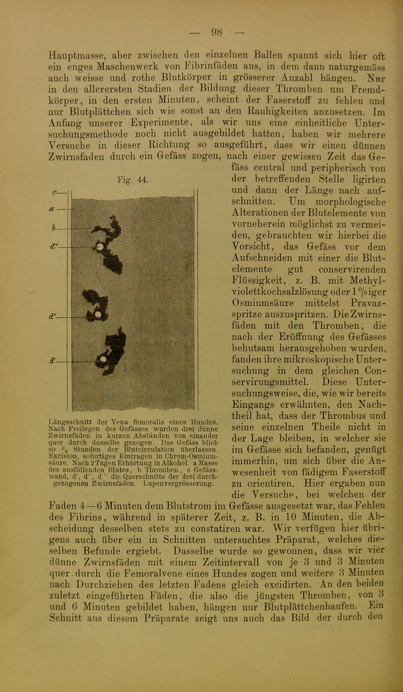 Hauptmasse, aber zwischen den einzelnen Ballen spannt sich hier oft ein enges Maschenwerk von Fibrinfaden aus, in dem dann naturgemäss auch weisse und rothe Blutkörper in grösserer Anzahl hängen. Nur in den allerersten Stadien der Bildung dieser Thromben um Fremd- körper, in den ersten Minuten, scheint der Faserstoff zu fehlen und nur Blutplättchen sich wie sonst an den Rauhigkeiten anzusetzen. Im Anfang unserer Experimente, als wir uns eine einheitliche Unter- suchungsmethode noch nicht ausgebildet hatten, haben wir mehrere Versuche in dieser Richtung so ausgeführt, dass wir einen dünnen Zwirnsfaden durch ein Grefäss zogen, nach einer gewissen Zeit das Ge- fäss central und peripherisch von der betreffenden Stelle ligirten und dann der Länge nach auf- schnitten. Um morphologische Alterationen der Blutelemente von vorneherein möglichst zu vermei- den, gebrauchten wir hierbei die Vorsicht, das Gefäss vor dem Aufschneiden mit einer die Blut- elemente gut conservirenden Flüssigkeit, z. B. mit Methyl- violettkochsalzlösung oder 1 /oiger Osmiumsäure mittelst Pravaz- spritze auszuspritzen. Die Zwirns- fäden mit den Thromben, die nach der Eröffnung des Gefässes behutsam herausgehoben wurden, fanden ihre mikroskopische Unter- suchung in dem gleichen Con- servirungsmittel. Diese Unter- suchungsweise, die, wie wir bereits Eingangs erwähnten, den Nach- theil hat, dass der Thrombus und seine einzelnen Theile nicht in der Lage bleiben, in welcher sie im Gefässe sich befanden, genügt immerhin, um sich über die An- wesenheit von fädigem Faserstoff zu Orientiren. Hier ergaben nun die Versuche, bei welchen der Faden 4—6 Minuten dem Blutstrom im Gefässe ausgesetzt war, das Fehlen des Fibrins, während in späterer Zeit, z. B. in 10 Minuten, die Ab- scheidung desselben stets zu constatiren war. Wir verfügen hier übri- gens auch über ein in Schnitten untersuchtes Präparat, welches die- selben Befunde ergiebt. Dasselbe wurde so gewonnen, dass wir vier dünne Zwirnsfäden mit einem Zeitintervall von je 3 und 3 Minuten quer.durch die Femoralvene eines Hundes zogen und weitere 3 Minuten nach Durchziehen des letzten Fadens gleich excidirten. An den beiden zuletzt eingeführten Fäden, die also die jüngsten Thromben, von 3 und 6 Minuten gebildet halDen, hängen nur Blutplättchenhaufen. Ein Schnitt aus diesem Präparate zeigt uns auch das Bild der durch den {iiijiwiiiiii»iyiiiii,iii,|j|||ji!,iiiiiiidj^ Längsschnitt der Vena femoralis eines Hundes. Nach Freilegen des Gefässes wurden di'ei dünne Zwirnsfäden in kurzen Abständen von einander quer durch dasselbe gezogen. Das Gefäss blieb so Stunden der Blutcirculation überlassen. Excision, sofortiges Eintragen in Chrom-Osmium- säure. Nach 2 Tagen Erhärtung in Alkohol, a Masse des ausfüllenden Blutes, b Thromben, c Gefäss- wand, d', d, d  die Querschnitte der drei durch- gezogenen Zwirnsfäden. Lupenvergrössening.