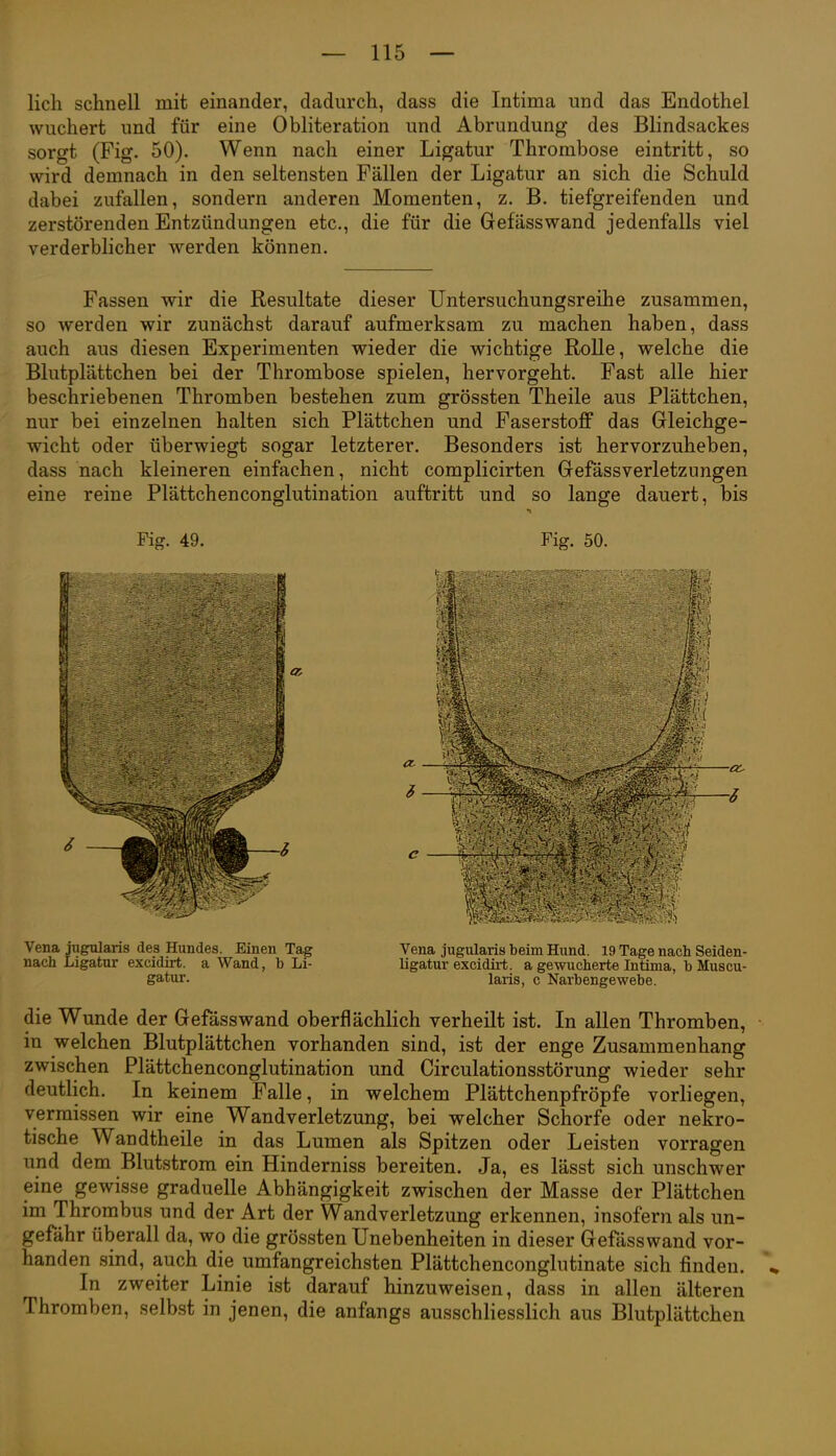 lieh schnell mit einander, dadurch, dass die Intima und das Endothel wuchert und für eine Obliteration und Abrundung des Blindsackes sorgt (Fig. 50). Wenn nach einer Ligatur Thrombose eintritt, so wird demnach in den seltensten Fällen der Ligatur an sich die Schuld dabei zufallen, sondern anderen Momenten, z. B. tiefgreifenden und zerstörenden Entzündungen etc., die für die Gefässwand jedenfalls viel verderblicher werden können. Fassen wir die Resultate dieser Untersuchungsreihe zusammen, so werden wir zunächst darauf aufmerksam zu machen haben, dass auch aus diesen Experimenten wieder die wichtige Rolle, welche die Blutplättchen bei der Thrombose spielen, hervorgeht. Fast alle hier beschriebenen Thromben bestehen zum grössten Theile aus Plättchen, nur bei einzelnen halten sich Plättchen und Faserstoff das Gleichge- wicht oder überwiegt sogar letzterer. Besonders ist hervorzuheben, dass nach kleineren einfachen, nicht complicirten Gefässverletzungen eine reine Plättchenconglutination auftritt und so lange dauert, bis die Wunde der Gefässwand oberflächlich verheilt ist. In allen Thromben, in welchen Blutplättchen vorhanden sind, ist der enge Zusammenhang zwischen Plättchenconglutination und Circulationsstörung wieder sehr deutlich. In keinem Falle, in welchem Plättchenpfröpfe vorliegen, vermissen wir eine Wandverletzung, bei welcher Schorfe oder nekro- tische Wandtheile in das Lumen als Spitzen oder Leisten vorragen und dem Blutstrom ein Hinderniss bereiten. Ja, es lässt sich unschwer eine gewisse graduelle Abhängigkeit zwischen der Masse der Plättchen im Thrombus und der Art der Wandverletzung erkennen, insofern als un- gefähr überall da, wo die grössten Unebenheiten in dieser Gefässwand vor- handen sind, auch die umfangreichsten Plättchenconglutinate sich finden. ^ In zweiter Linie ist darauf hinzuweisen, dass in allen älteren Thromben, selbst in jenen, die anfangs ausschliesslich aus Blutplättchen Fig. 49. Fig. 50. Vena jugularis des Hundes. Einen Tag nach Ligatur excidirt. a Wand, b Li- gatur. Vena jugularis beim Hund. 19 Tage nach Seiden- ligatur excidirt. a gewucherte Intima, b Muscu- laris, c Narbengewebe.