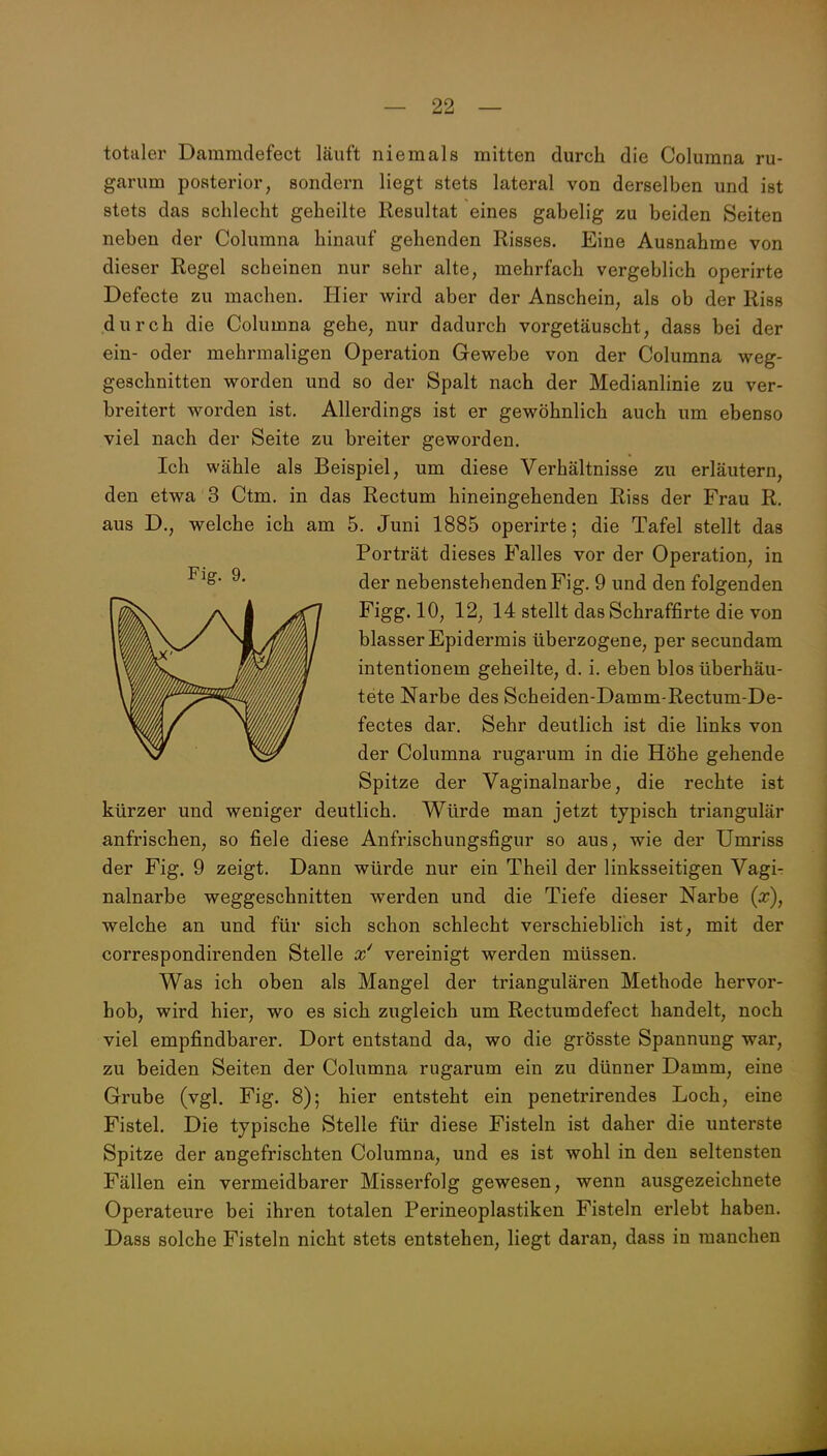 totaler Dammdefect läuft niemals mitten durch die Columna ru- garum posterior, sondern liegt stets lateral von derselben und ist stets das schlecht geheilte Resultat eines gabelig zu beiden Seiten neben der Columna hinauf gehenden Risses. Eine Ausnahme von dieser Regel scheinen nur sehr alte, mehrfach vergeblich operirte Defecte zu machen. Hier wird aber der Anschein, als ob der Riss durch die Columna gehe, nur dadurch vorgetäuscht, dass bei der ein- oder mehrmaligen Operation Gewebe von der Columna weg- geschnitten worden und so der Spalt nach der Medianlinie zu ver- breitert worden ist. Allerdings ist er gewöhnlich auch um ebenso viel nach der Seite zu breiter geworden. Ich wähle als Beispiel, um diese Verhältnisse zu erläutern, den etwa 3 Ctm. in das Rectum hineingehenden Riss der Frau R. aus D., welche ich am 5. Juni 1885 operirte; die Tafel stellt das Porträt dieses Falles vor der Operation, in der nebenstehenden Fig. 9 und den folgenden Figg. 10, 12, 14 stellt das Schraffirte die von blasser Epidermis überzogene, per secundam intentionem geheilte, d. i. eben blos überhäu- tete Narbe des Scheiden-Damm-Rectum-De- fectes dar. Sehr deutlich ist die links von der Columna rugarum in die Höhe gehende Spitze der Vaginalnarbe, die rechte ist kürzer und weniger deutlich. Würde man jetzt typisch triangulär anfrischen, so fiele diese Anfrischungsfigur so aus, wie der Umriss der Fig. 9 zeigt. Dann würde nur ein Theil der linksseitigen Vagi- nalnarbe weggeschnitten werden und die Tiefe dieser Narbe (x), welche an und für sich schon schlecht verschieblich ist, mit der correspondirenden Stelle vereinigt werden müssen. Was ich oben als Mangel der triangulären Methode hervor- hob, wird hier, wo es sich zugleich um Rectumdefect handelt, noch viel empfindbarer. Dort entstand da, wo die grösste Spannung war, zu beiden Seiten der Columna rugarum ein zu dünner Damm, eine Grube (vgl. Fig. 8); hier entsteht ein penetrirendes Loch, eine Fistel. Die typische Stelle für diese Fisteln ist daher die unterste Spitze der angefrischten Columna, und es ist wohl in den seltensten Fällen ein vermeidbarer Misserfolg gewesen, wenn ausgezeichnete Operateure bei ihren totalen Perineoplastiken Fisteln erlebt haben. Dass solche Fisteln nicht stets entstehen, liegt daran, dass in manchen