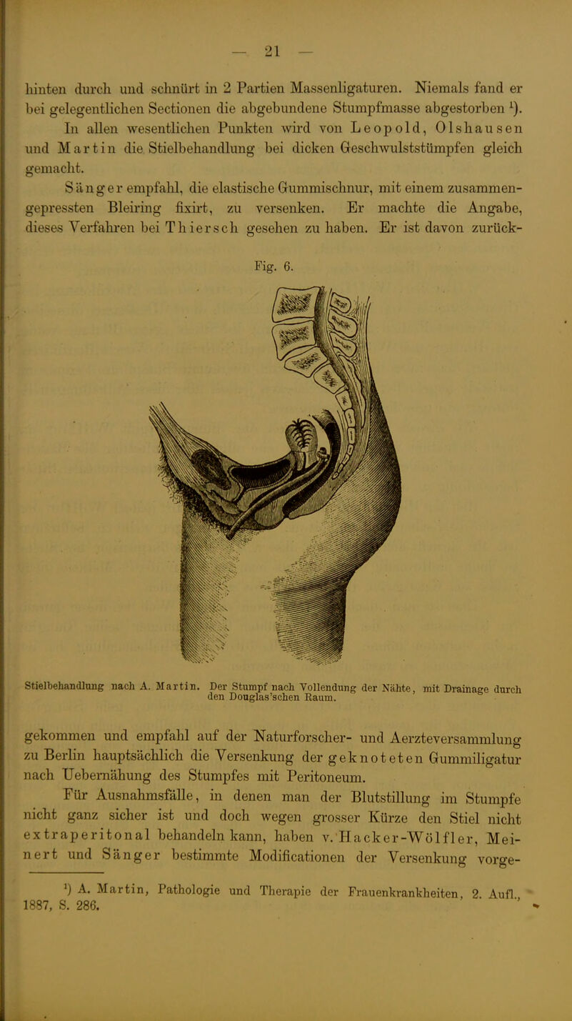 hinten durch und schnürt in 2 Partien Massenligaturen. Niemals fand er bei gelegentlichen Sectionen die abgebundene Stumpfmasse abgestorben In allen wesentlichen Punkten wird von Leopold, Olshausen und Martin die Stielbehandlung bei dicken Geschwulststümpfen gleich gemacht. S ä n g e r empfahl, die elastische Gummischnur, mit einem zusammen- gepressten Bleiring fixirt, zu versenken. Er machte die Angabe, dieses Verfahren bei Thiersch gesehen zu haben. Er ist davon zurück- Fig. 6. Stielbehandlung nach A. Martin. Der Stumpf nach Vollendung der Nähte, mit Drainage durch den Douglas'schen Raum. gekommen und empfahl auf der Naturforscher- und Aerzteversammluns zu Berlin hauptsächlich die Versenkung der geknoteten Gummiligatur nach TJebemähung des Stumpfes mit Peritoneum. Für Ausnahmsfälle, in denen man der Blutstillung im Stumpfe nicht ganz sicher ist und doch wegen grosser Kürze den Stiel nicht extraperitonal behandeln kann, haben v. Hacker-Wölfler, Mei- nert und Sänger bestimmte Modificationen der Versenkung vorge- ^) A. Martin, Pathologie und Therapie der Frauenkrankheiten, 2 Aufl 1887, S. 286.