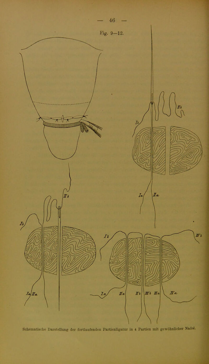 Fig. 9-12.