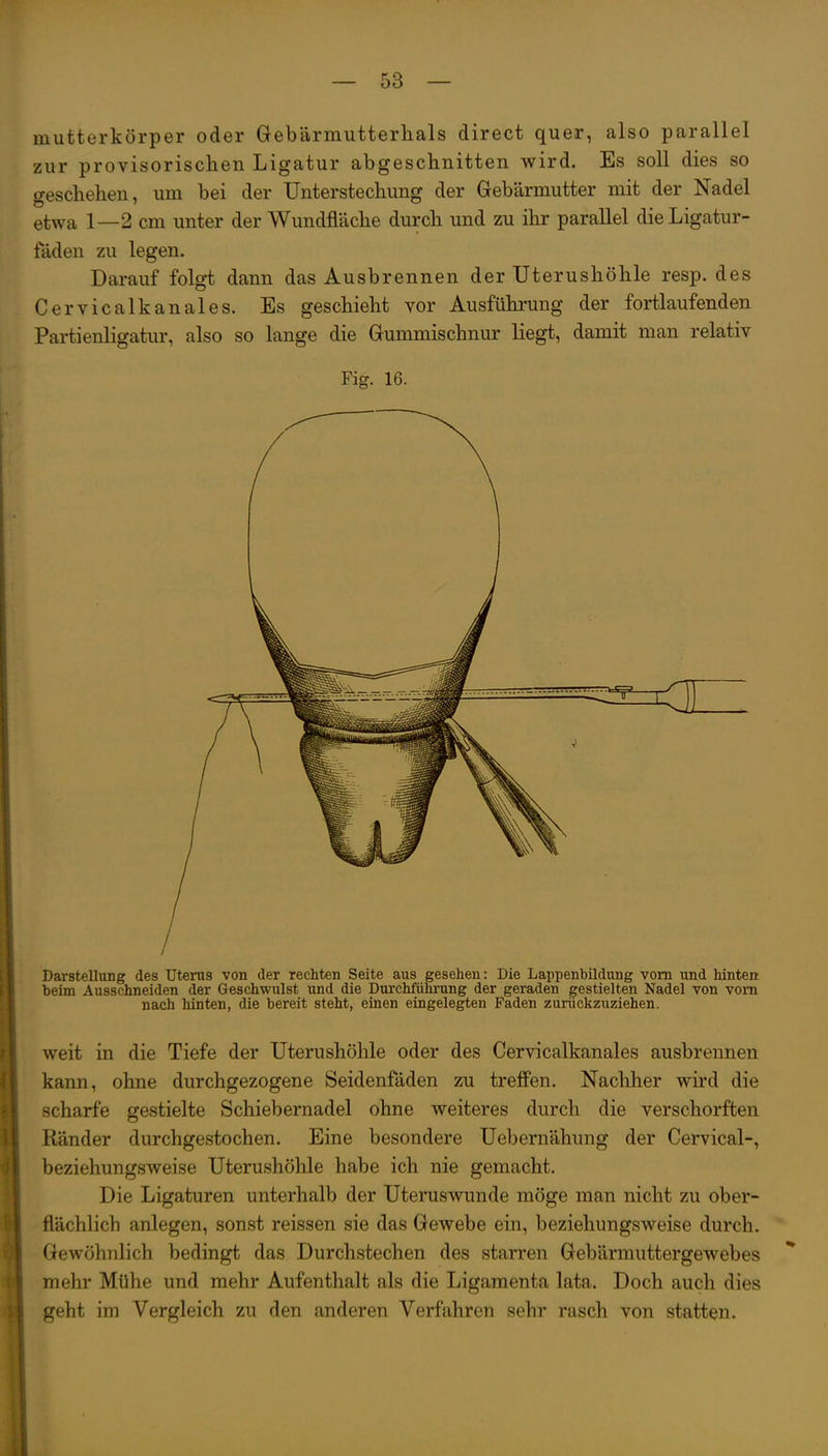 mutterkörper oder Gebärmutterhals direct quer, also parallel zur provisorischen Ligatur abgeschnitten wird. Es soll dies so geschehen, um bei der Unterstechung der Gebärmutter mit der Nadel etwa 1—2 cm unter der Wundfläche durch und zu ihr parallel dieLigatur- filden zu legen. Darauf folgt dann das Ausbrennen der TJterushöhle resp. des Cervicalkanales. Es geschieht vor Ausführung der fortlaufenden Partienligatur, also so lange die Gummischnur liegt, damit man relativ Fig. 16. Darstellung des Utenis von der rechten Seite aus gesehen: Die Lappenbildung vom und hinten beim Ausschneiden der Geschwulst und die Durchführung der geraden gestielten Nadel von vom nach hinten, die bereit steht, einen eingelegten Faden zurückzuziehen. weit in die Tiefe der Uterushöhle oder des Cervicalkanales ausbrennen kann, ohne durchgezogene Seidenfäden zu treffen. Naclilier wird die scharfe gestielte Schiebernadel ohne weiteres durch die verschorften Ränder durchgestochen. Eine besondere Uebernähung der Cervical-, beziehungsweise Uterushöhle habe ich nie gemacht. Die Ligaturen unterhalb der Uteruswunde möge man nicht zu ober- flächlich anlegen, sonst reissen sie das Gewebe ein, beziehungsweise durch. Gewöhnlich bedingt das Durchstechen des starren Gebärmuttergewebes mehr Mühe und mehr Aufenthalt als die Ligamenta lata. Doch auch dies geht im Vergleich zu den anderen Verfahren sehr rasch von statten.