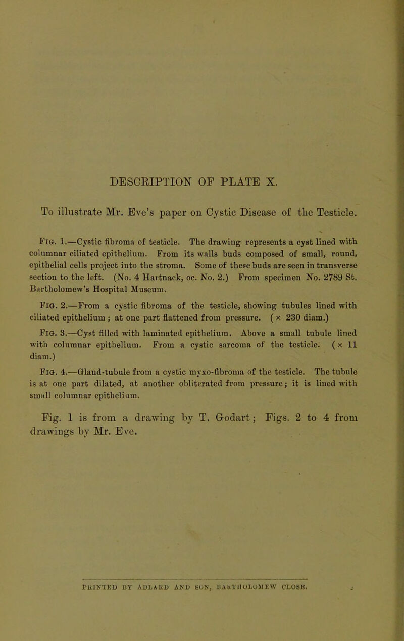 DESCRIPTION OF PLATE X. To illustrate Mr. Eve's i^aper on Cystic Disease of the Testicle. Fro. 1.—Cystic fibroma of testicle. The drawing represents a cyst lined with columnar ciliated epithelium. From its walls buds composed of small, round, epithelial cells project into the stroma. Some of these buds are seen in transverse section to the left. (No. 4 Hartnack, oc. No. 2.) From specimen No. 2789 St. Bartholomew's Hospital Museum. Fig. 2.—From a cystic fibroma of the testicle, showing tubules lined with ciliated epithelium ; at one part flattened from pressure. ( x 230 diam.) Fig. 3.—Cyst filled with laminated epithelium. Above a small tubule lined with columnar epithelium. From a cystic sarcoma of tlie testicle. (x 11 diam.) Fig. 4.^—Gland-tubule from a cystic myxo-fibroma of the testicle. The tubule is at one part dilated, at another obliterated from pressure; it is lined with small columnar epithelium. Fig. 1 is from a drawing by T. Godart; Figs. 2 to 4 from drawings by Mr. Eve. PlilMhD Br ADLAUl) AND SON, IIAUTIIOLUMEW CL08B.