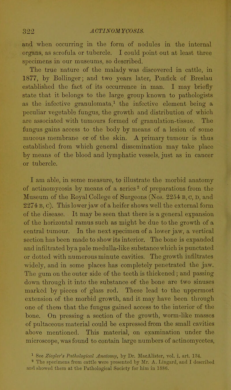 and when occurring in the form of nodules in the internal organs, as scrofula or tubercle. I could point out at least three specimens in our museums, so described. The true nature of the malady was discovered in cattle, in 1877, by Bollinger; and two years later, Ponfick of Breslau established the fact of its occurrence in man. I may briefly state that it belongs to the large group known to pathologists as the infective granulomata/ the infective element being a peculiar vegetable fungus, the growth and distribution of Avhich are associated with tumours formed of granulation-tissue. The fungus gains access to the body by means of a lesion of some mucous membrane or of the skin. A primary tumour is thus established from which general dissemination may take place by means of the blood and lymphatic vessels, just as in cancer or tubercle. I am able, in some measure, to illustrate the morbid anatomy of actinomycosis by means of a series ^ of preparations from the Museum of the Royal College of Surgeons (Nos. 22.54 B, c, D, and 2274 B, c). This lower jaw of a heifer shows well the external form of the disease. It may be seen that there is a general ej^pansion of the horizontal ramus such as might be due to the growth of a central tumour. In the next specimen of a lower jaw, a vertical section has been made to show its interior. The bone is expanded and infiltrated by a pale medulla-like substance which is punctated or dotted with numerous minute cavities. The growth infiltrates widely, and in some places has completely penetrated the jaw. The gum on the outer side of the teeth is thickened; and passing down through it into the substance of the bone are two sinuses marked by pieces of glass rod. These lead to the uppermost extension of the morbid growth, and it may have been tlirough one of them that the fungus gained access to the interior of the bone. On pressing a section of the growth, worm-like masses of pultaceous material could be expressed from the small cavities above mentioned. This material, on examination under the microscope, was found to contain large numbers of actinomycetes, ^ See Zicgler's Pathological Anatomy, by Dr. JfacAHster, vol. i. art. 134. * The specimens from cattle were ]iresoiite(l by Mr. A. Liiiganl, ami I described and showed them at tlie Pathological Society for liim iii 1886.