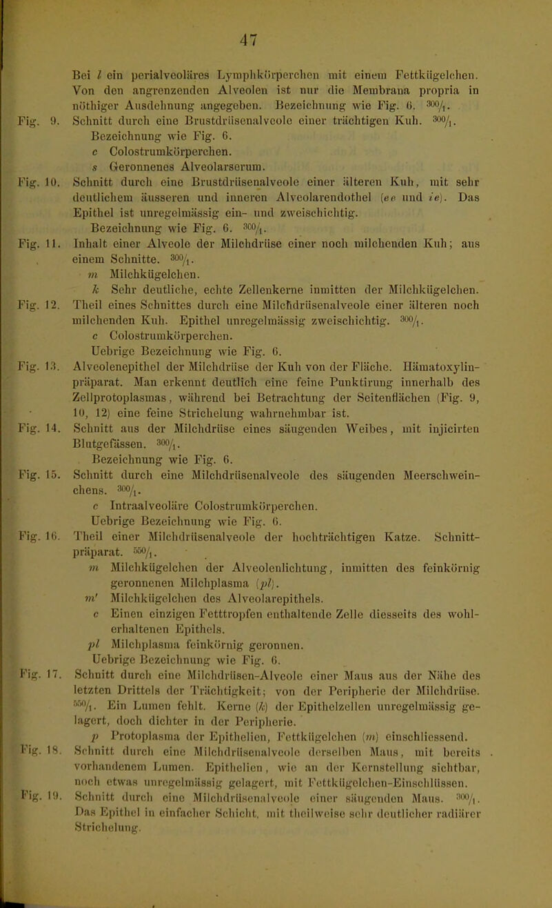 Bei l ein porialvooliires Lymplikiiiperclien mit einem Fettkiigelchcn. Von den angrenzenden Alveolen ist nur die Membrana propria in nüthiger Ausdehnung angegeben. liezelchnung wie Fig. (i. Fig. 9. Schnitt durch eine Brustdriisenalvcolc einer trächtigen Kuh. ^oo/i. Bezeichnung wie Fig. 6. e Colostrumkörperchen. s Geronnenes Alveolarserum. Fig. 10. Schnitt durcli eine Brustdriisenalvcolc einer älteren Kuh, mit sehr deutlichem äusseren und inneren Alveolarendothel [ee und ie]. Das Epithel ist unregelmässig ein- und zweischichtig. Bezeichnung wie Fig. 6. m/,. Fig. 11. Inhalt einer Alveole der Milchdrüse einer noch milchenden Kuh; aus einem Schnitte. 3oo/,. m Milchkügelchen. k Sehr deutliche, echte Zellenkerne Inmitten der Milchkügelchen. Fig. 12. Theil eines Schnittes durch eine Milchdriisenalveole einer älteren noch milchenden Kuh. Epithel unregelraässig zweischichtig, ^oo/,. c Colostrumkörperchen. Uebrigc Bezeichnung wie Fig. 6. Fig. 13. Alveolenepithel der Milchdrüse der Kuh von der Fläche. Hämatoxylin- präparat. Man erkennt deutlich eine feine Punktirung innerhalb des Zellprotoplasmas, während bei Betrachtung der Seitenflächen (Fig. 9, 10, 12) eine feine Strichelung wahrnehmbar ist. Fig. 14. Schnitt aus der Milchdrüse eines säugenden Weibes, mit injicirten Blutgefässen. 30o/i. Bezeichnung wie Fig. 6. Fig. 15. Schnitt durch eine Milchdrüsenaiveole des säugenden Meerschwein- chens. c Intraalveoläre Colostrumkörperchen. Uebrige Bezeichnung wie Fig. ö. Fig. Ki. Theil einer Milchdrüsenalveole der hoch trächtigen Katze. Schnitt- präparat. ä50/i. in Milchkügelchen der Alveolenlichtung, inmitten des feinkörnig geronnenen Milchplasma m' Milchkiigolchcn de.s Alveolarepithels. c Einen einzigen Fetttropfen enthaltende Zelle diesseits des wohl- erhaltenen Epithels. pl Milchplasnia feinkörnig geronnen. Uebrige Bezeichnung wie Fig. G. Fig. 17. Schnitt durch eine Milchdrüsen-Alveolc einer Maus aus der Nähe des letzten Drittels der Trächtigkeit; von der Peripherie der Milchdrüse. Ein Lumen fehlt. Kerne [k) der Epithelzellcn unregelmässig ge- lagert, doch dichter in der Peripherie. }) Protoplasma der Epithelicn, Fottkügelchen (m) cinschliessend. Fig. 18. Schnitt durch eine Milchdriiseualvcole derselben Maus, mit bereits vorhandenem Lumen. Epithelicn, wie an der Kernstellung sichtbar, noch etwas imrogelniäsHig gelagert, mit Fettkügelchen-Einschlü.ssen. Fig. Schnitt durch eine Milchdrüsenalveole einer säugenden Maus. ='^Vi- Das Epithel in einfacher Schicht, mit thcilweise sehr deutlicher radiärer Strichelung.