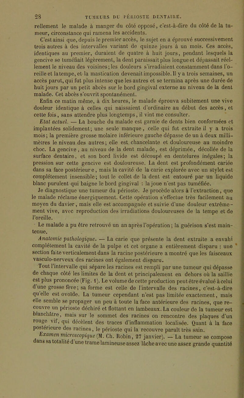 rellement le malade à manger du côté opposé, c'est-à-dire du côté de la tu- meur, circonstance qui ramena les accidents. C'est ainsi que, depuis le premier accès, le sujet en a éprouvé successivement trois autres à des intervalles variant de quinze jours à un mois. Ces accès, identiques au premier, duraient de quatre à huit jours, pendant lesquels la gencive se tuméfiait légèrement, la dent paraissait plus longue et dépassait réel- lement le niveau des voisines; les douleurs s'irradiaient constamment dans l'o- reille et latempe, et la mastication devenaitimpossible.il y a trois semaines, un accès parut, qui fut plus intense que les autres et se termina après une durée de huit jours par un petit abcès sur le bord gingival externe au niveau de la dent malade. Cet abcès s'ouvrit spontanément. Enfin ce matin même, à dix heures, le malade éprouva subitement une vive douleur identique à celles qui naissaient d'ordinaire au début des accès, et cette fois, sans attendre plus longtemps, il vint me consulter. Etal actuel. — La bouche du malade est garnie de dents bien conformées et implantées solidement-, une seule manque, celle qui fut extraite il y a trois mois; la première grosse molaire inférieure gauche dépasse de un à deux milli- mètres le niveau des autres; elle est chancelante et douloureuse au moindre choc. La gencive , au niveau de la dent malade, est déprimée, décollée de la surface dentaire, et son bord livide est découpé en dentelures inégales; la pression sur cette gencive est douloureuse. La dent est profondément cariée dans sa face postérieure, mais la cavité de la carie explorée avec un stylet est complètement insensible; tout le collet de la dent est entouré par un liquide blanc purulent qui baigne le bord gingival : la joue n'est pas tuméfiée. Je diagnostique une tumeur du périoste. Je procède alors à l'extraction, que le malade réclame énergiquement. Cette opération s'effectue très facilement au moyen du davier, mais elle est accompagnée et suivie d'une douleur extrême- ment vive, avec reproduction des irradiations douloureuses de la tempe et de l'oreille. Le malade a pu être retrouvé un an après l'opération ; la guérison s'est main- tenue. Anatomie pathologique. — La carie que présente la dent extraite a envahi complètement la cavité de la pulpe et cet organe a entièrement disparu : une section faite verticalement dans la racine postérieure a montré que les faisceaux vasculo-nerveux des racines ont également disparu. Tout l'intervalle qui sépare les racines est rempli par une tumeur qui dépasse de chaque côté les limites de la dent et principalement en dehors où la saillie est plus prononcée (Fig. 1). Le volume de cette production peut être évalué à celui d'une grosse fève; sa forme est celle de Tintervalle des racines, c'est-à-dire qu'elle est ovoïde. La tumeur cependant n'est pas limitée exactement, mais elle semble se propager un peu à toute la face antérieure des racines, que re- couvre un périoste déchiré et flottant en lambeaux. La couleur de la tumeur est blanchâtre, mais sur le sommet des racines on rencontre des plaques d'un rouge vif, qui décèlent des traces d'inflammation localisée. Quant à la face postérieure des racines, le périoste qui la recouvre paraît très sain. Examen microscopique [n. Ch. Robin, 27 janvier). - La tumeur se compose dans sa totalité d'une trame lamineuse assez lâche avec une assez grande quantité