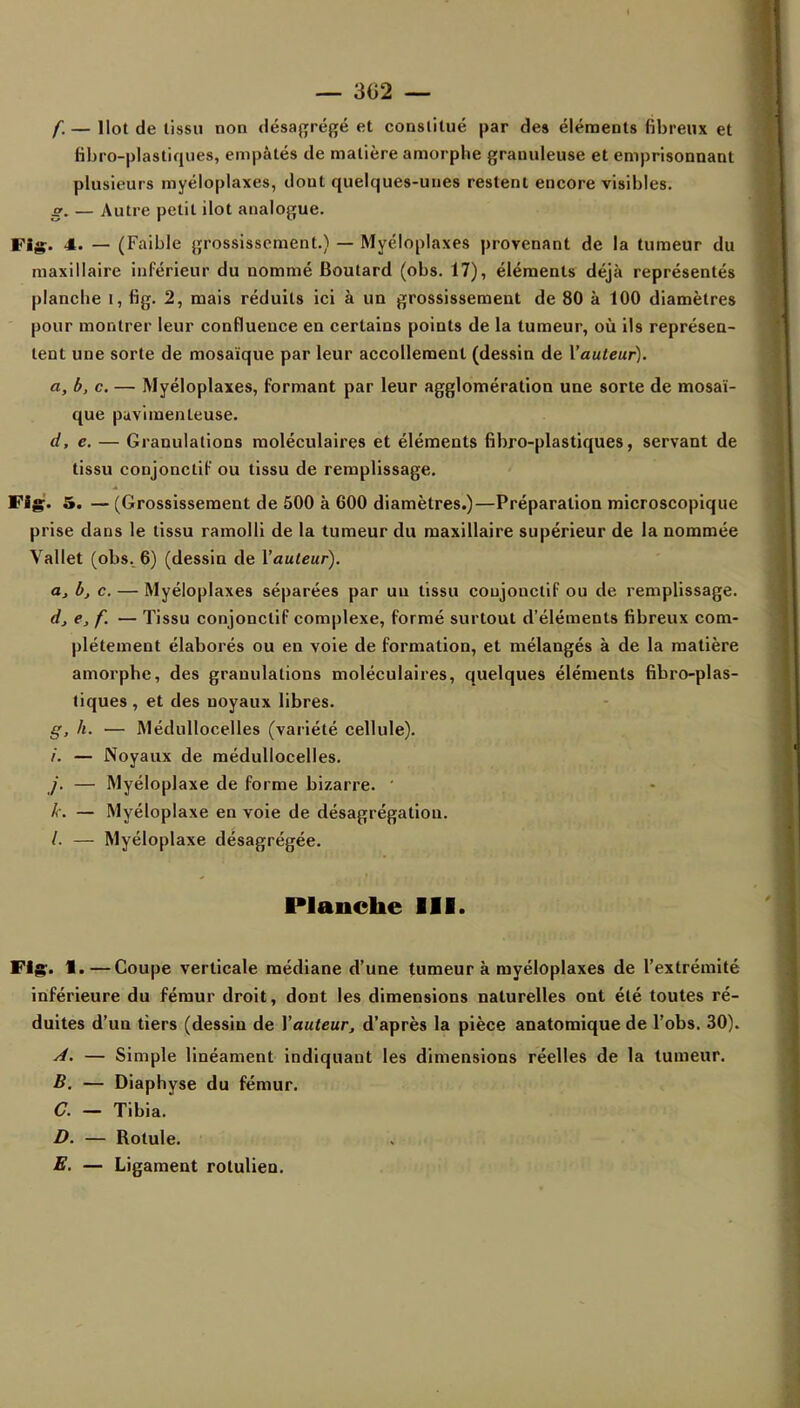 — 302 — f. — Ilot de tissu non désagrégé et constitué par de» éléments fibreux et fibro-plastiques, empâtés de matière amorphe granuleuse et emprisonnant plusieurs myéloplaxes, dont quelques-unes restent encore visibles. s. — Autre petit ilot analogue. Fig;. 4. — (Faible grossissement.) — Myéloplaxes provenant de la tumeur du maxillaire inférieur du nommé Boutard (obs. 17), éléments déjà représentés planche i, fig. 2, mais réduits ici à un grossissement de 80 à 100 diamètres pour montrer leur confluence en certains points de la tumeur, où ils représen- tent une sorte de mosaïque par leur accollemenl (dessin de l'auteur). a, b, c. — Myéloplaxes, formant par leur agglomération une sorte de mosaï- que puvimenteuse. d, e. — Granulations moléculaires et éléments fibro-plastiques, servant de tissu conjonctif ou tissu de remplissage. Fig. 5. — (Grossissement de 500 à 600 diamètres.)—Préparation microscopique prise dans le tissu ramolli de la tumeur du maxillaire supérieur de la nommée Vallet (obs. 6) (dessin de l'auteur). a, bj c. — Myéloplaxes séparées par uu tissu conjonctif ou de remplissage. d> f. — Tissu conjonctif complexe, formé surtout d'éléments fibreux com- plètement élaborés ou en voie de formation, et mélangés à de la matière amorphe, des granulations moléculaires, quelques éléments fibro-plas- tiques , et des noyaux libres. g, h. — Médullocelles (variété cellule). i. — Noyaux de médullocelles. j. — Myéloplaxe de forme bizarre. k. — Myéloplaxe en voie de désagrégation. /. — Myéloplaxe désagrégée. Planche III. Fig. 1.—Coupe verticale médiane d'une tumeur k myéloplaxes de l'extrémité inférieure du fémur droit, dont les dimensions naturelles ont été toutes ré- duites d'un tiers (dessin de l'auteur, d'après la pièce anatoraique de l'obs. 30). A. — Simple linéament indiquant les dimensions réelles de la tumeur. B. — Diaphyse du fémur. C. — Tibia. D. — Rotule. E. — Ligament rotulien.