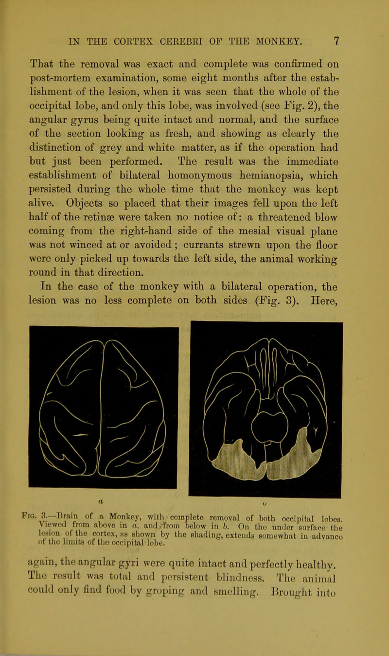 That the removal was exact and complete was confijmed on post-mortem examination, some eight months after the estab- lishment of the lesion, when it was seen that the whole of the occipital lobe, and only this lobe, was involved (see Fig. 2), the angular gyrus being quite intact and normal, and the surface of the section looking as fresh, and showing as clearly the distinction of grey and white matter, as if the operation had but just been performed. The result was the immediate establishment of bilateral homonymous hemianopsia, which persisted during the whole time that the monkey was kept alive. Objects so placed that their images fell upon the left half of the retinae were taken no notice of: a threatened blow coming from the right-hand side of the mesial visual plane was not winced at or avoided ; currants strewn upon the floor were only picked up towards the left side, the animal working round in that direction. In the case of the monkey with a bilateral operation, the lesion was no less complete on both sides (Fig. 3). Here, Fig. 3.—Brain of a Monkey, witli complete removal of both occipital lobes Viewed from above in a, and,from below in b. On the under surface tiio lesion of the cortex, as shown by the shading, extends somewhat in advance of the limits of the occipital lobe. again, the angular gyri were quite intact and perfectly healthy. The result was total and persistent blindness. The animal could only find food by groping and smelling, lirought into