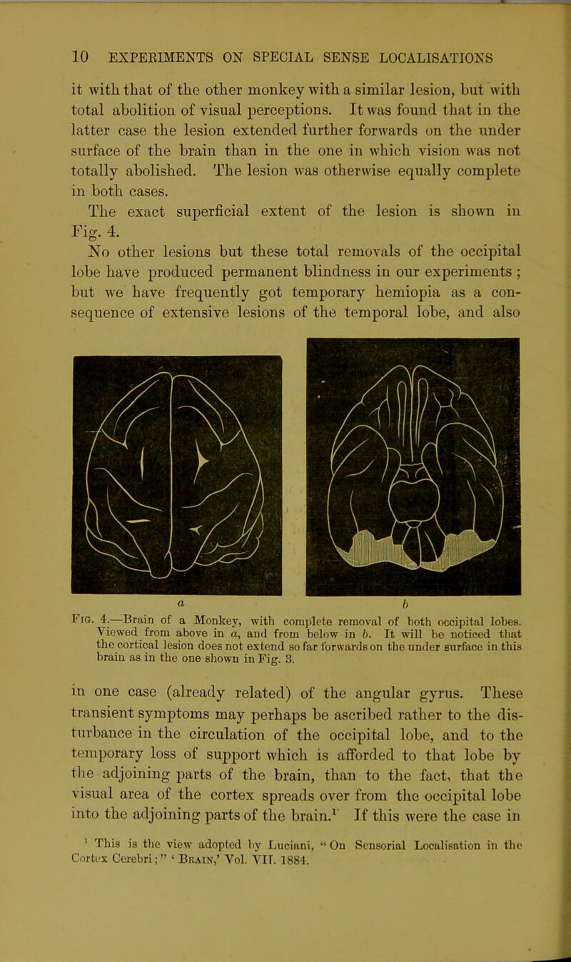 it with that of the other monkey with a similar lesion, but with total abolition of visual perceptions. It was found that in the latter case the lesion extended further forwards on the under surface of the brain than in the one in which vision was not totally abolished. The lesion was otherwise equally complete in both cases. The exact superficial extent of the lesion is shown in Fig. 4. No other lesions but these total removals of the occipital lobe have produced permanent blindness in our experiments ; but we have frequently got temporary hemiopia as a con- sequence of extensive lesions of the temporal lobe, and also a h Fig. 4.—Brain of a Monkey, witli complete removal of both occipital lobes. Viewed from above in o, and from below in h. It will bo noticed that the cortical lesion does not extend so far Ibrwardson the under surface in this brain as in the one shown in Fig. 3. in one case (already related) of the angular gyrus. These transient symptoms may perhaps be ascribed rather to the dis- turbance in the circulation of the occipital lobe, and to the temporary loss of support which is afforded to that lobe by the adjoining parts of the brain, than to the fact, that the visual area of the cortex spreads over from the occipital lobe into the adjoining parts of the brain.^ If this were the case in ' This is the view adopted by Luciani, On Sensorial Localisation in the Cortex Cerebri; ' Brain,' Vol. VIT. 1884.