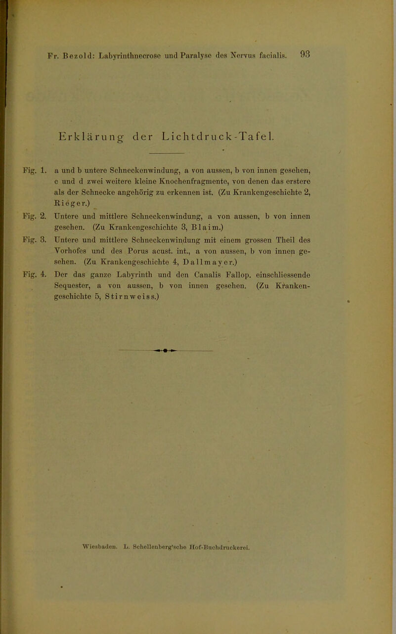 Erklärung der Lichtdruck-Tafel. Fig. 1. a und b untere Schneckonwindung, a von aussen, b von innen gesehen, c und d zwei weitere kleine Knochenfragmente, von denen das erstere als der Schnecke angehörig zu erkennen ist. (Zu Krankengeschichte 2, Riöger.) Fig. 2. Untere und mittlere Schneckonwindung, a von aussen, b von innen gesehen. (Zu Krankengeschichte 3, Blaim.) Fig. 3. Untere und mittlere Schneckenwindung mit einem grossen Theil dos Vorhofes und des Porus acust. int., a von aussen, b von innen ge- sehen. (Zu Krankengeschichte 4, Dalimayer.) Fig. 4. Der das ganze Labyrinth und den Canalis Fallop. einschliessende Sequester, a von aussen, b von innen gesehen. (Zu Kranken- goschichte 5, Stirn weiss.) Wiesbaden, h. Schollonborg'scho Hof-Iiuchilruckcroi.