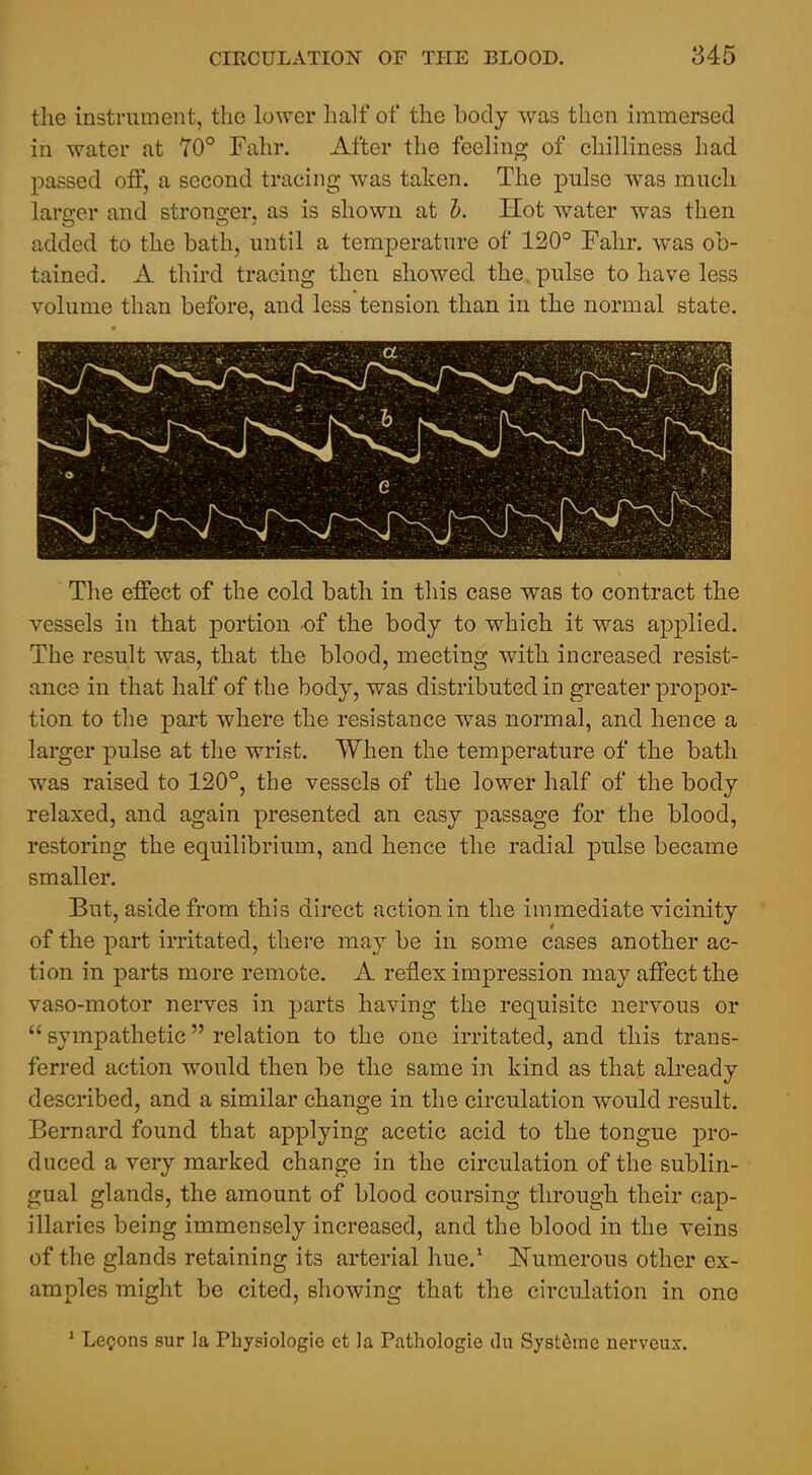 the instrument, the lower half of the body was then immersed in water at 70° Fahr. After the feeling of chilliness had passed off, a second tracing was taken. The pulse was much larger and stronfrer, as is shown at h. Hot water was then added to the bath, until a temperature of 120° Fahr. was ob- tained. A third tracing then showed the, pulse to have less volume than before, and less tension than in the normal state. The effect of the cold bath in this case was to contract the vessels in that portion of the body to which it was applied. The result was, that the blood, meeting with increased resist- ance in that half of the body, was distributed in greater propor- tion to tlie part where the resistance was normal, and hence a larger pulse at the wrist. When the temperature of the bath was raised to 120°, the vessels of the lower half of the body relaxed, and again presented an easy passage for the blood, restoring the equilibrium, and hence the radial pulse became smaller. But, aside from this direct action in the immediate vicinity of the part irritated, there may be in some cases another ac- tion in parts more remote. A reflex impression may affect the vaso-motor nerves in parts having the requisite nervous or  sympathetic relation to the one irritated, and this trans- ferred action would then be the same in kind as that already described, and a similar change in the circulation would result. Bernard found that applying acetic acid to the tongue j)ro- duced a very marked change in the circulation of the sublin- gual glands, the amount of blood coursing through their cap- illaries being immensely increased, and the blood in the veins of the glands retaining its arterial hue.* Numerous other ex- amples might be cited, showing that the circulation in one ' Lessons sur la Physiologic ct la Pathologie du Syst6rae nerveus.