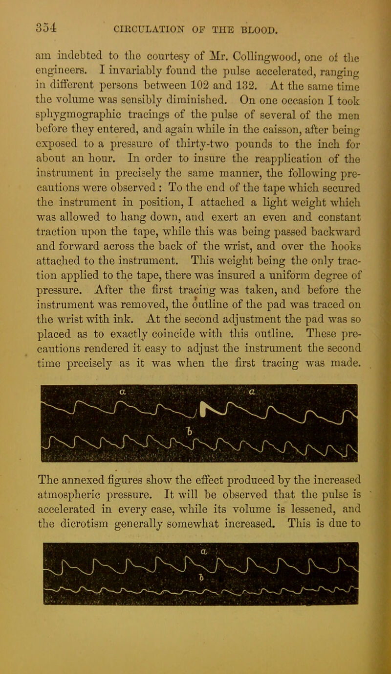 am indebted to tlie courtesy of Mr. CoUingwood, one of the engineers. I invaricably found the pulse accelerated, ranging in different persons between 102 and 132. At the same time the volume was sensibly diminished. On one occasion I took sphygmographic tracings of the pulse of several of the men before they entered, and again while in the caisson, after being exposed to a pressure of thirty-two pounds to the inch for about an hour. In order to insure the reapplication of the instrument in precisely the same manner, the following pre- cautions were observed : To the end of the tape which secured the instrument in position, I attached a light weight which was allowed to hang down, and exert an even and constant traction upon the tape, while this was being passed backward and forward across the back of the wrist, and over the hooks attached to the instrument. This weight being the only trac- tion applied to the tape, there was insured a uniform degree of pressm*e. After the first tracing was taken, and before the instrument was removed, the outline of the pad was traced on the wrist with ink. At the second adjustment the pad was so placed as to exactly coincide with this outline. These pre- cautions rendered it easy to adjust the instrument the second time precisely as it was when the first tracing was made. The annexed figures show the effect produced by the increased atmospheric pressure. It will be observed that the pulse is accelerated in every case, while its volume is lessened, and the dicrotism generally somewhat increased. This is due to