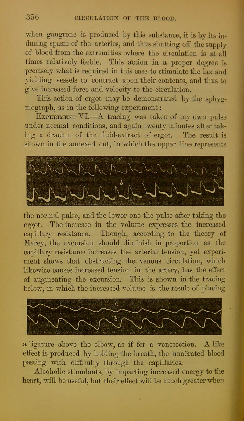 35G when gangrene is produced by this substance, it is by its in- ducing spasm of the arteries, and thus shutting off the supply of blood from the extremities where the circulation is at all times relatively feeble. This axjtion in a proper degree is precisely what is required in this case to stimulate the lax and yielding vessels to contract upon their contents, and thus to give increased force and velocity to the circulation. This action of ergot may be demonstrated by the sphyg- mograph, as in the following experiment: Experiment YI.—A tracing was taken of my own pulse under normal conditions, and again twenty minutes after tak- ing a drachm of the fluid-extract of ergot. The result is shown in the annexed cut, in which the upper line rej)resent3 the normal pulse, and the lower one the pulse after taking the ergot. The increase in the volume expresses the increased capillary resistance. Though, according to the theory of Marey, the excursion should diminish in proportion as the capillary resistance increases the arterial tension, yet experi- ment shows that obstructing the venous circulation, which likewise causes increased tension in the artery, has the effect of augmenting the excursion. This is shown in the tracing below, in which the increased volume is the result of placing a ligature above the elbow, as if for a venesection. A like effect is produced by holding the breath, the unaerated blood passing with difficulty through the capillaries. Alcoholic stimulants, by imparting increased energy to the heart, will be useful, but their effect will be much greater when